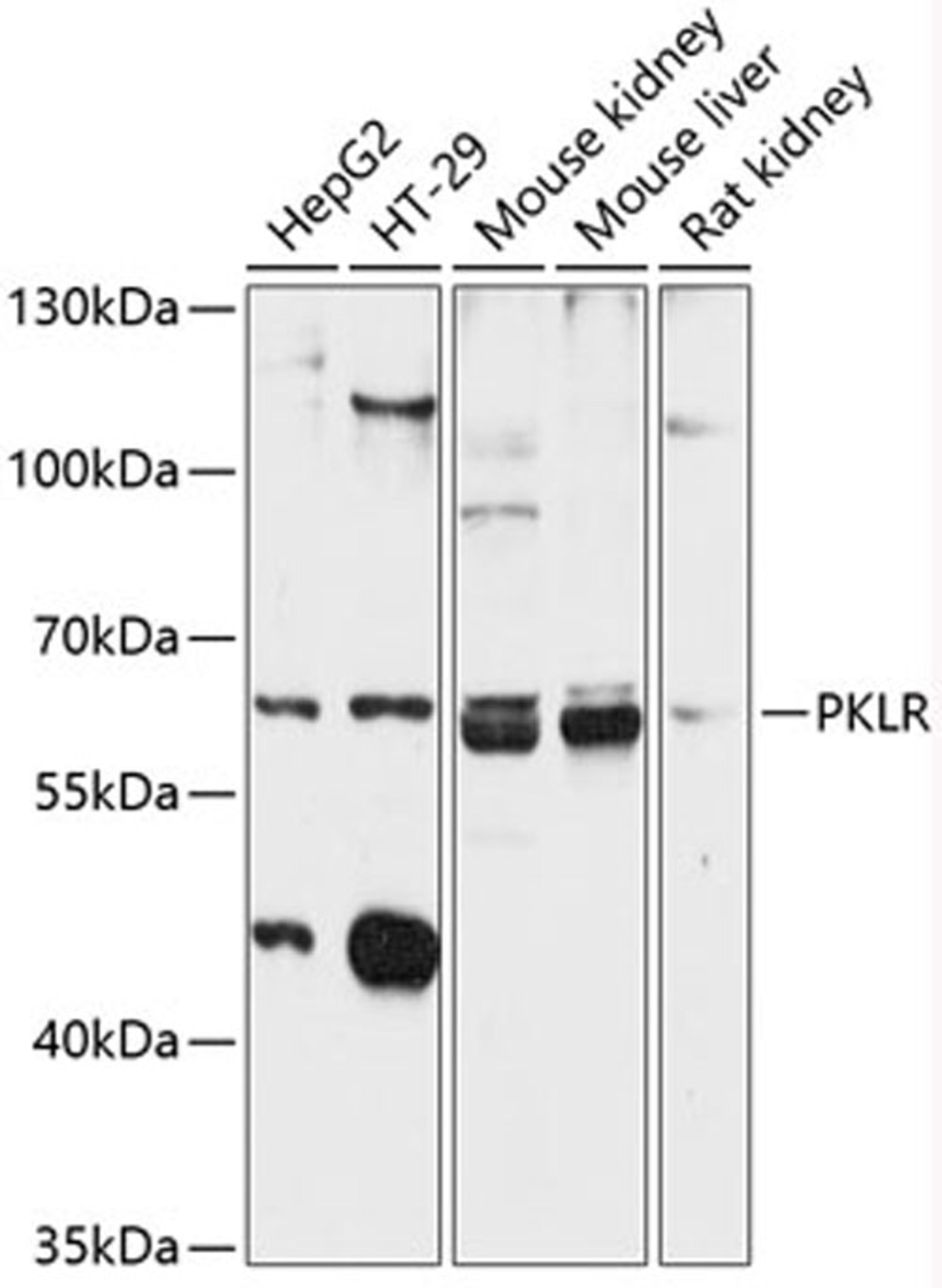 Western blot - PKLR antibody (A12336)