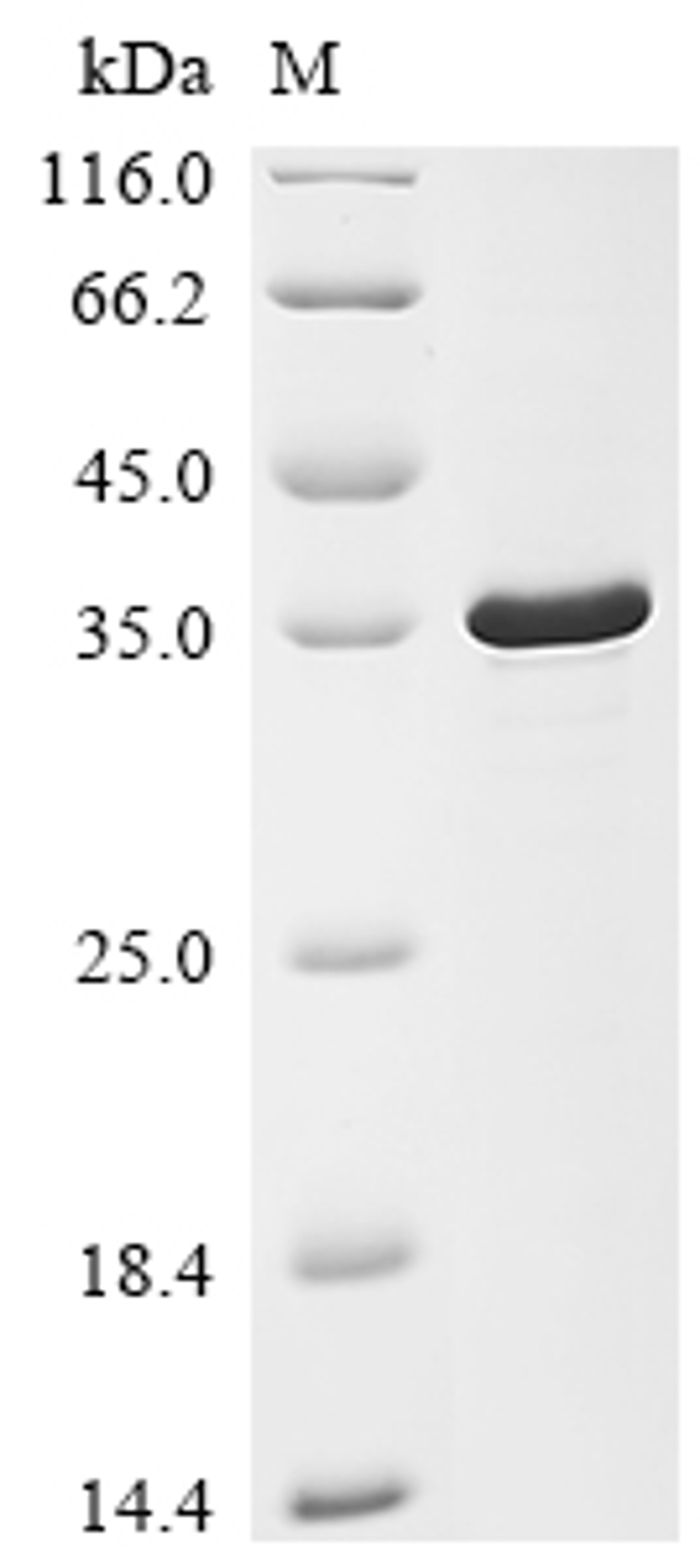 (Tris-Glycine gel) Discontinuous SDS-PAGE (reduced) with 5% enrichment gel and 15% separation gel.