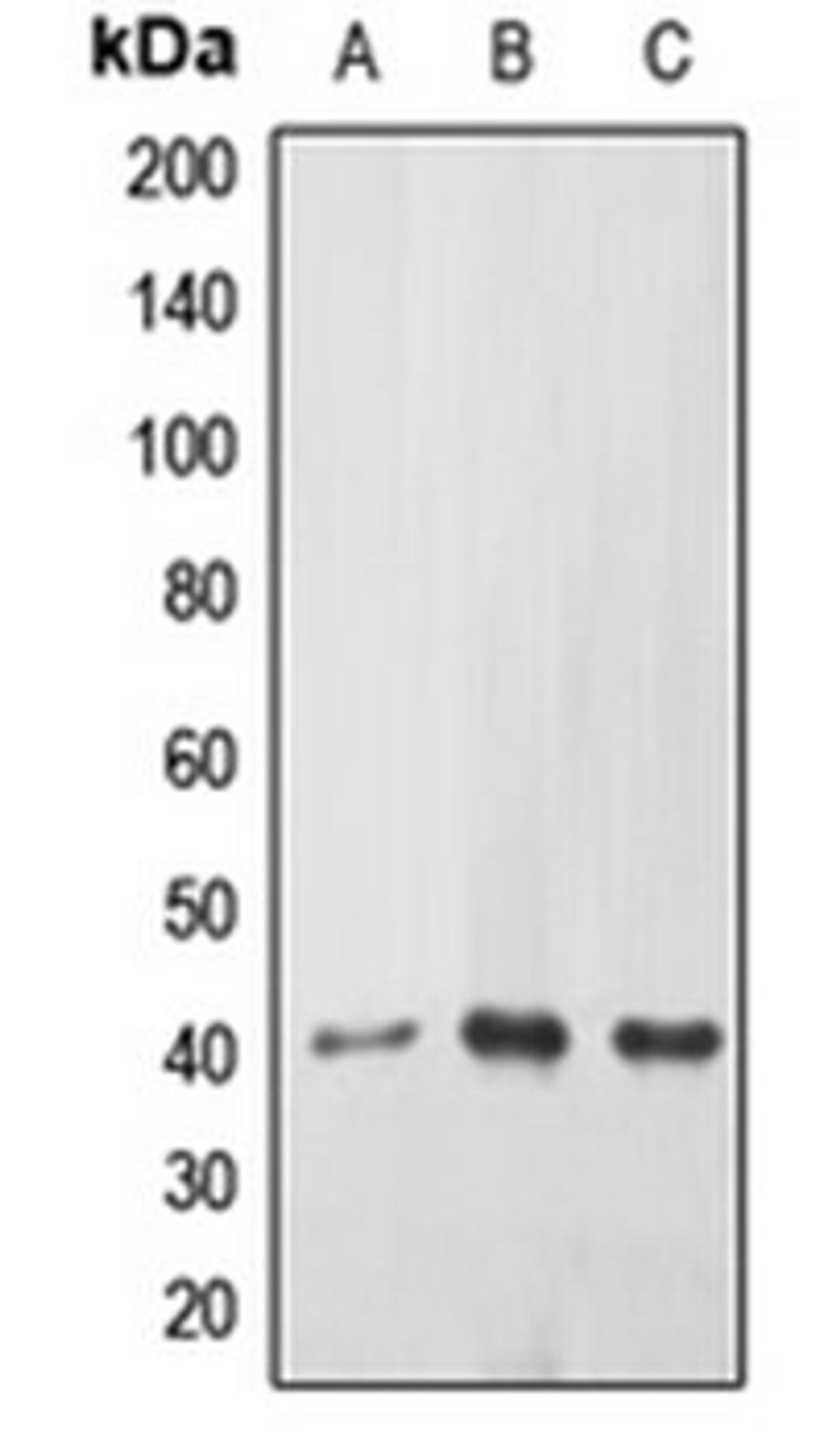 Western blot analysis of HEK239T (Lane 1), mouse kidney (Lane 2), rat kidney (Lane 3) whole cell lysates using EPHX3 antibody