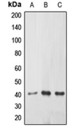 Western blot analysis of HEK239T (Lane 1), mouse kidney (Lane 2), rat kidney (Lane 3) whole cell lysates using EPHX3 antibody