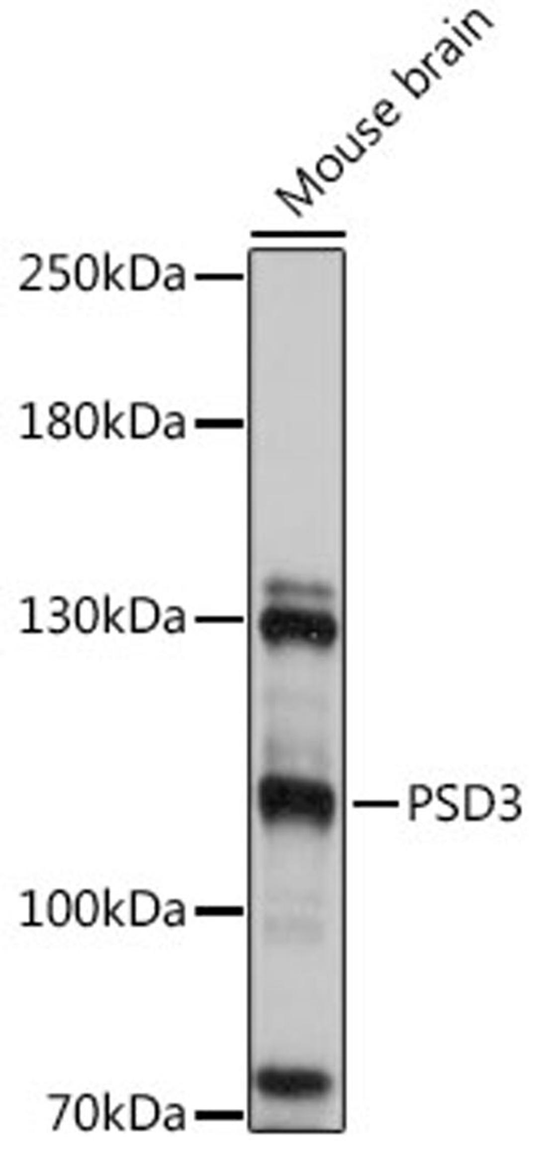 Western blot - PSD3 antibody (A16888)