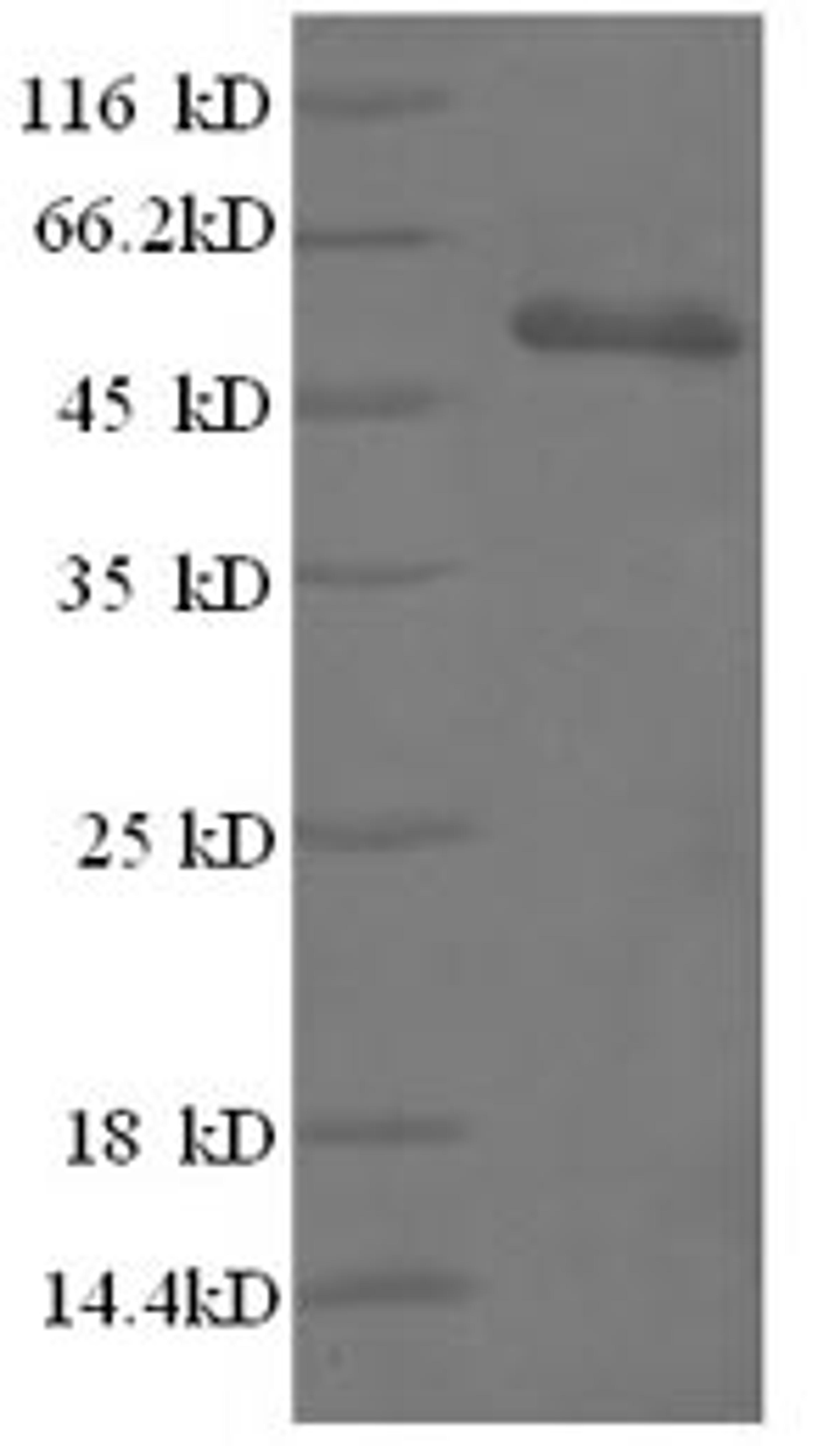 (Tris-Glycine gel) Discontinuous SDS-PAGE (reduced) with 5% enrichment gel and 15% separation gel.