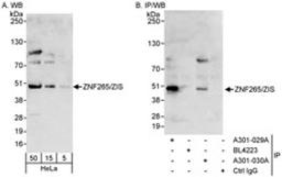 Detection of human ZNF265/ZIS by western blot and immunoprecipitation.