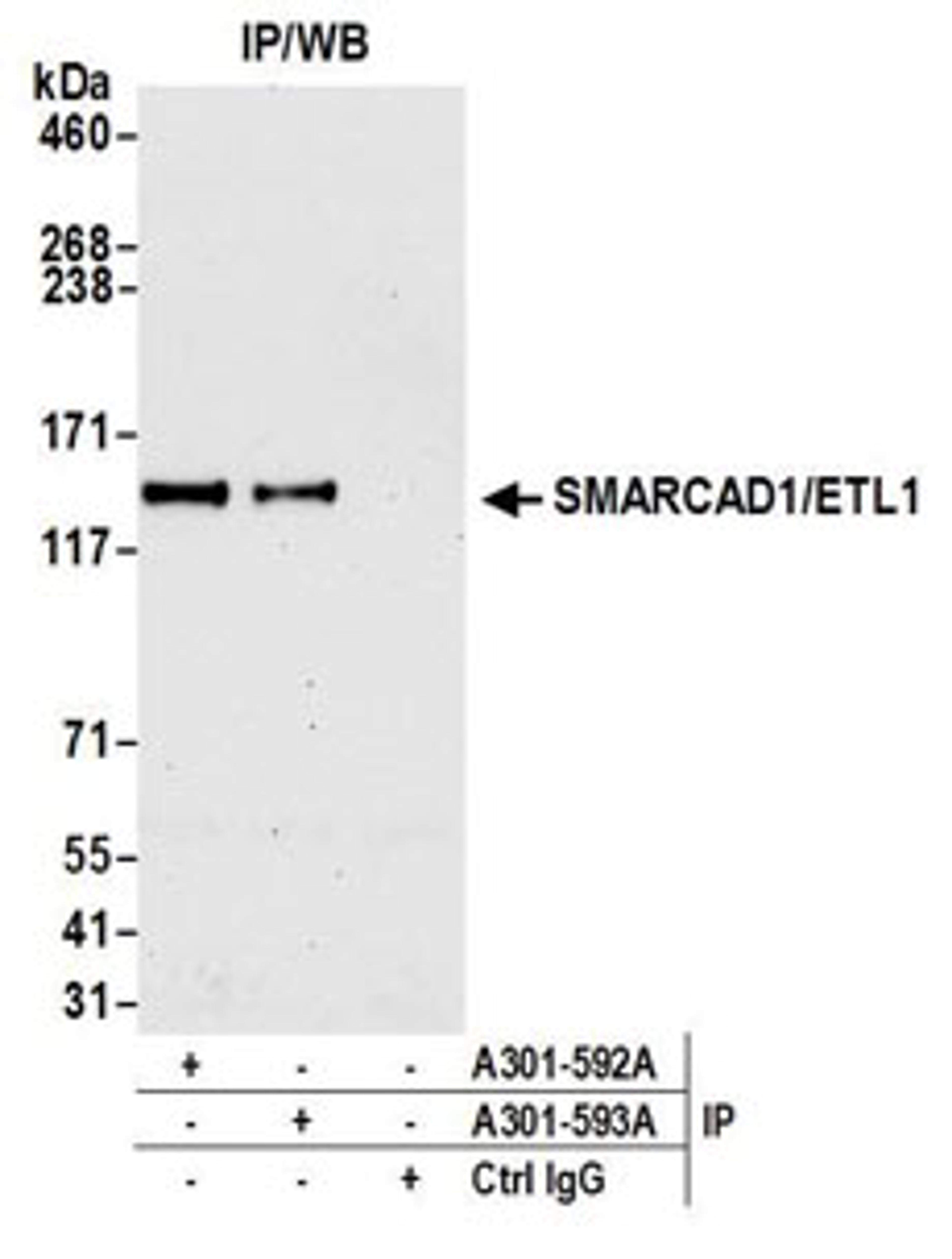 Detection of human SMARCAD1/ETL1 by western blot of immunoprecipitates.