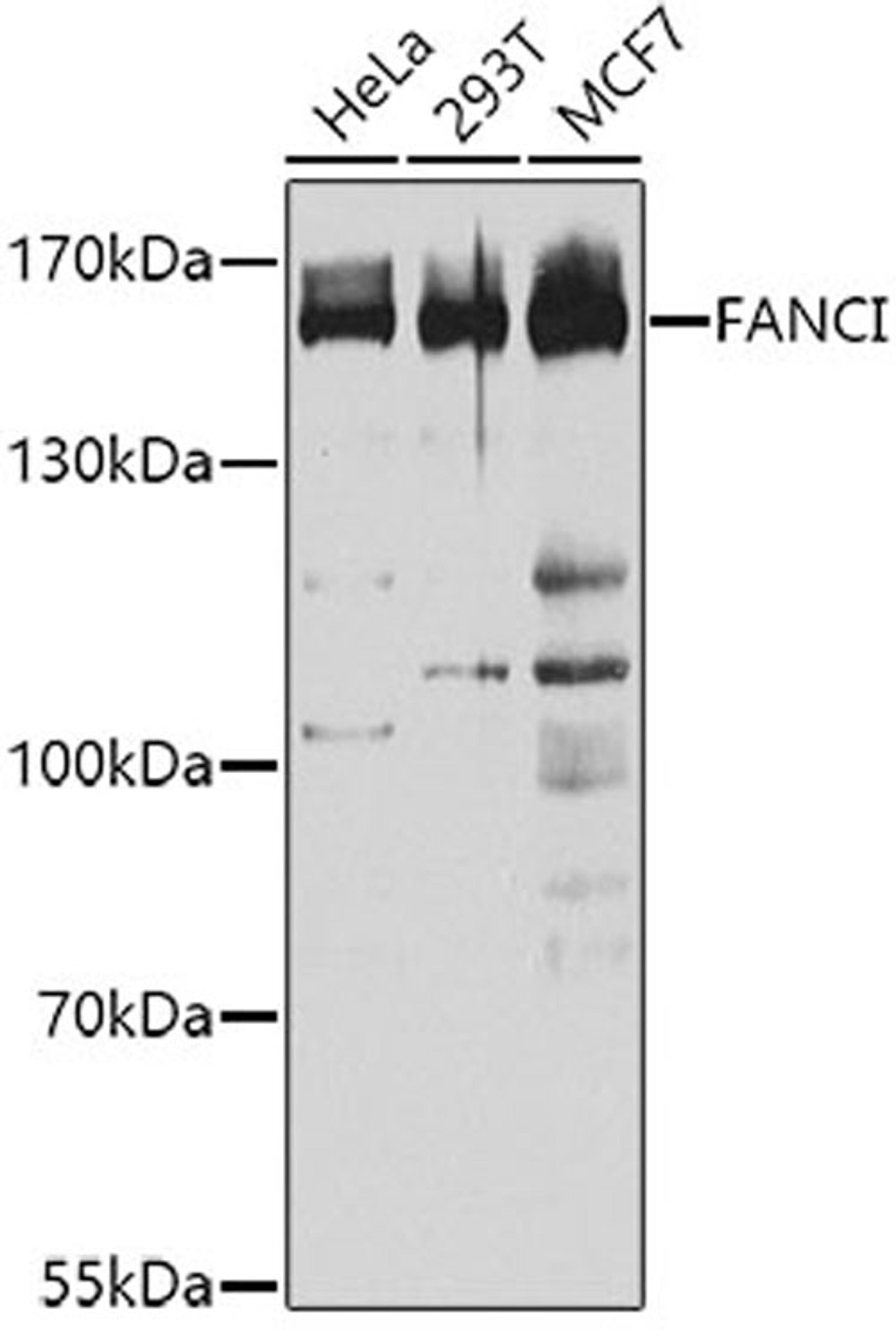 Western blot - FANCI antibody (A3447)