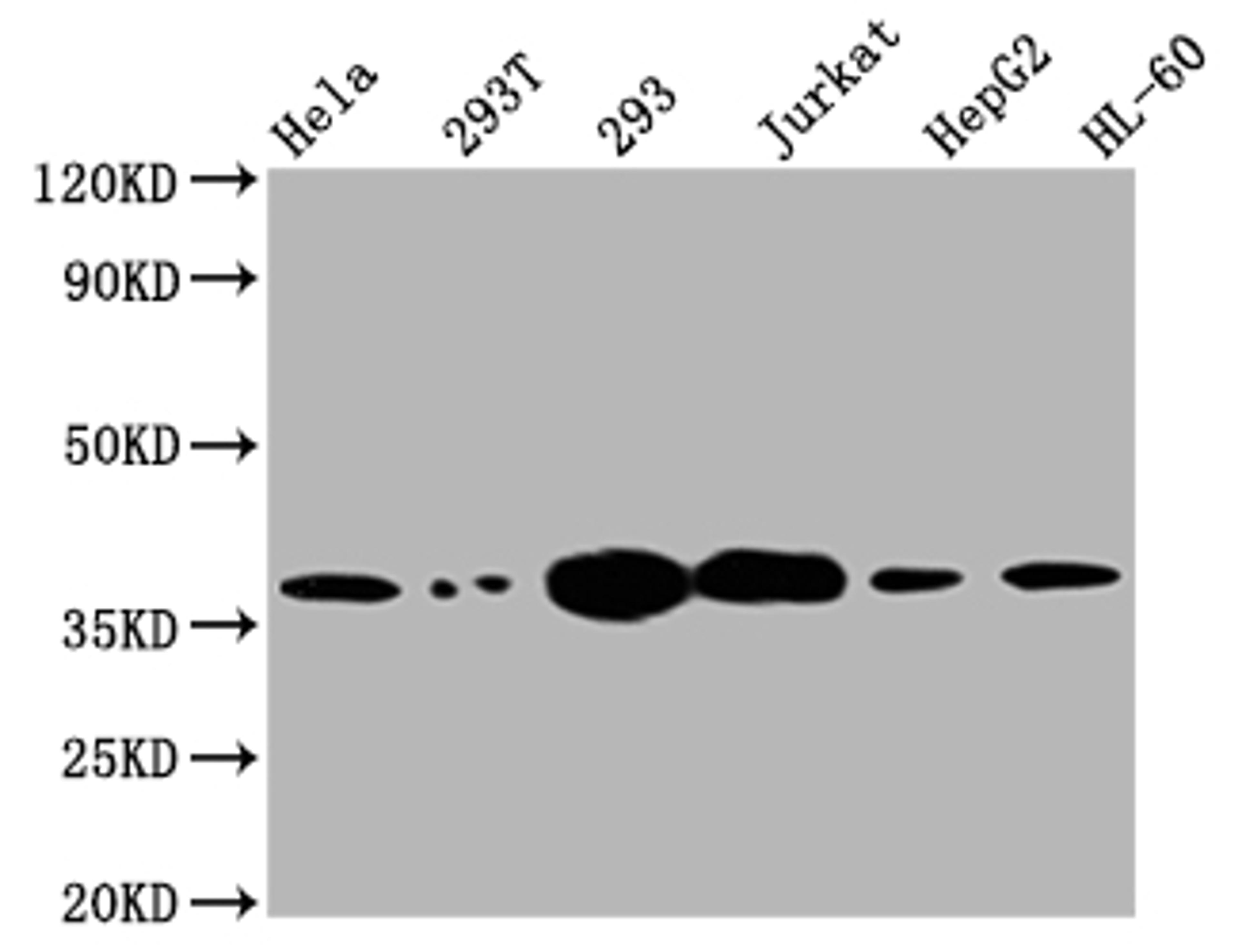 Western Blot. Positive WB detected in: Hela whole cell lysate, 293T whole cell lysate, 293 whole cell lysate, Jurkat whole cell lysate, HepG2 whole cell lysate, HL-60 whole cell lysate. All lanes: Thymidylate Synthase antibody at 1:2000. Secondary. Goat polyclonal to rabbit IgG at 1/50000 dilution. Predicted band size: 36, 32, 27 kDa. Observed band size: 36 kDa. 