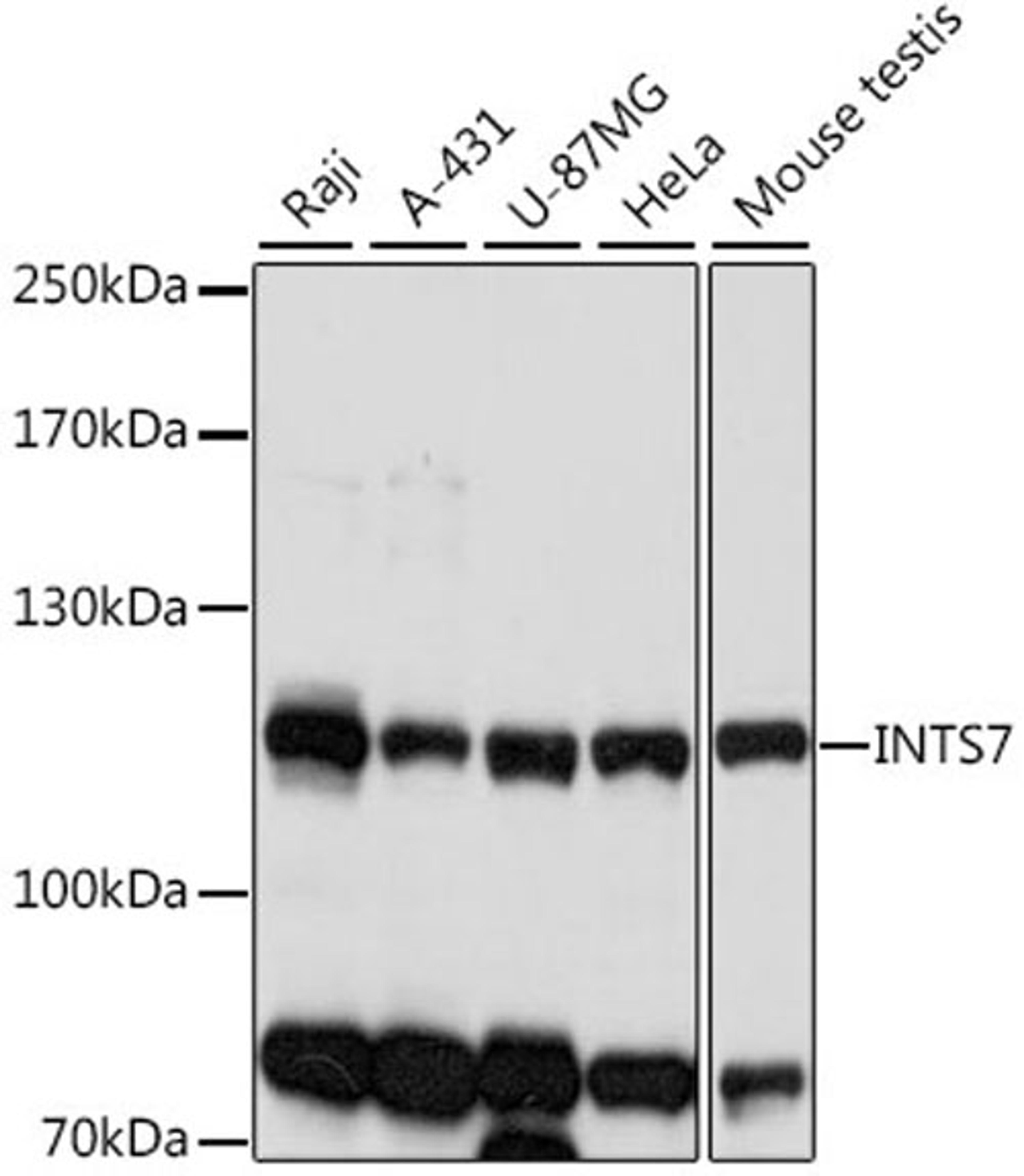 Western blot - INTS7 antibody (A16113)