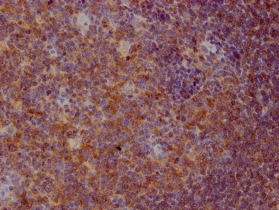 IHC image of CSB-RA962691A0HU diluted at 1:100 and staining in paraffin-embedded human tonsil tissue performed on a Leica BondTM system. After dewaxing and hydration, antigen retrieval was mediated by high pressure in a citrate buffer (pH 6.0). Section was blocked with 10% normal goat serum 30min at RT. Then primary antibody (1% BSA) was incubated at 4℃ overnight. The primary is detected by a Goat anti-rabbit IgG polymer labeled by HRP and visualized using 0.05% DAB.