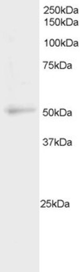 45-965 staining (2ug/ml) of Daudi cell lysate (RIPA buffer, 20ug total protein per lane). Detected by chemiluminescence.