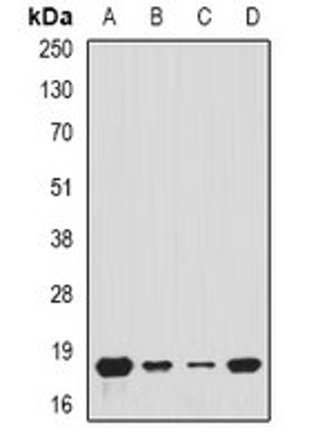 Western blot analysis of A549 (Lane1), MCF7 (Lane2), mouse kidney (Lane3), mouse heart (Lane4) whole cell lysates using TIMM17A antibody