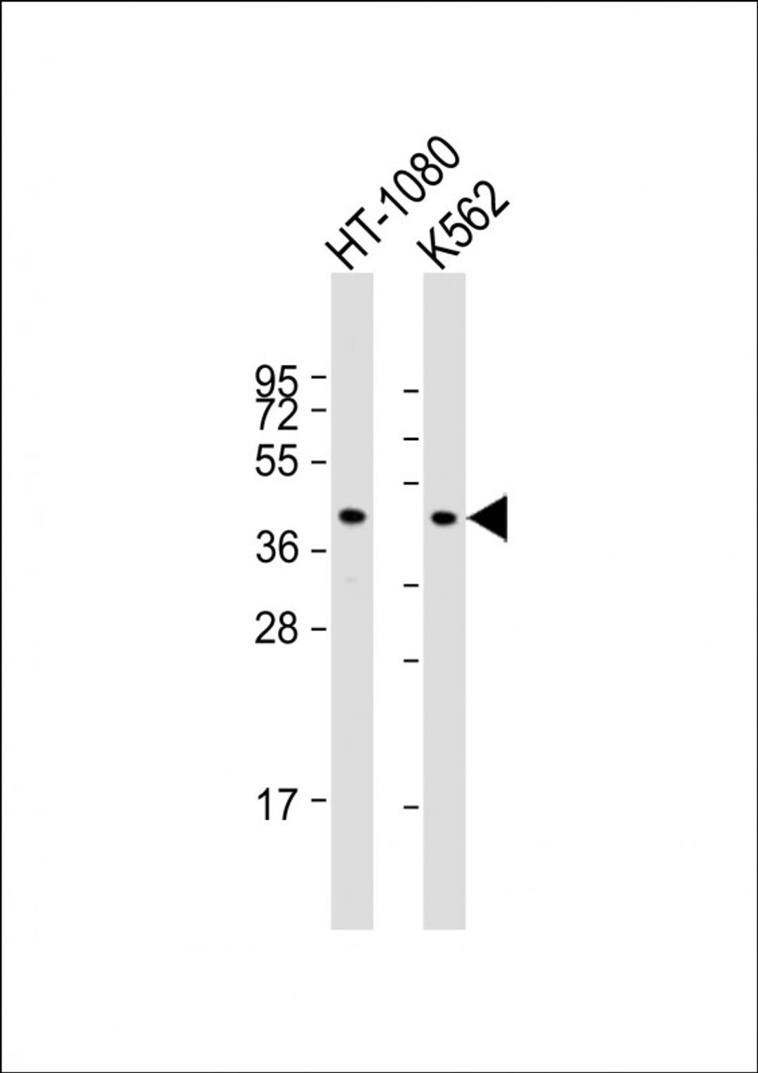 Western Blot at 1:1000 dilution Lane 1: HT-1080 whole cell lysate Lane 2: K562 whole cell lysate Lysates/proteins at 20 ug per lane.