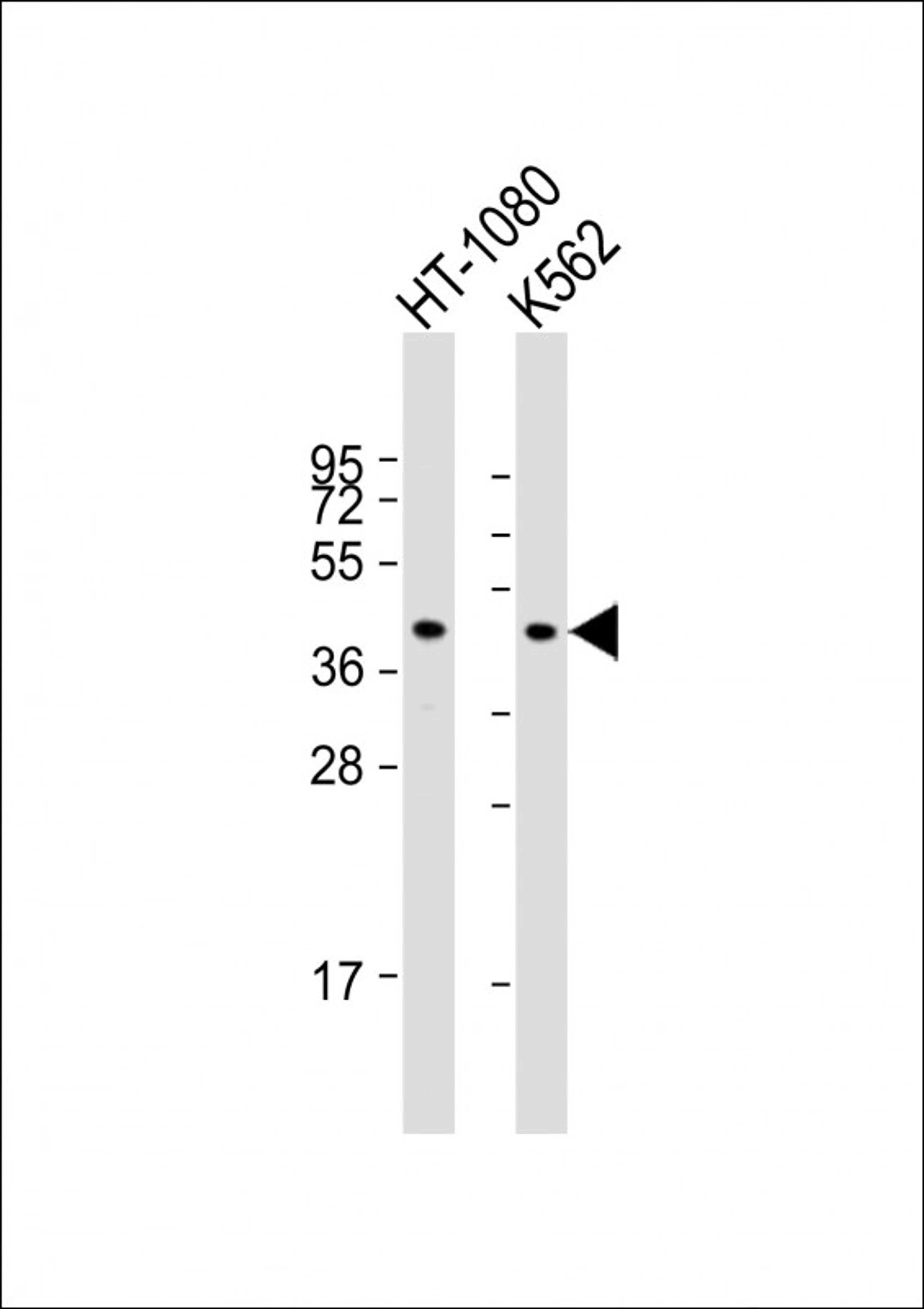 Western Blot at 1:1000 dilution Lane 1: HT-1080 whole cell lysate Lane 2: K562 whole cell lysate Lysates/proteins at 20 ug per lane.