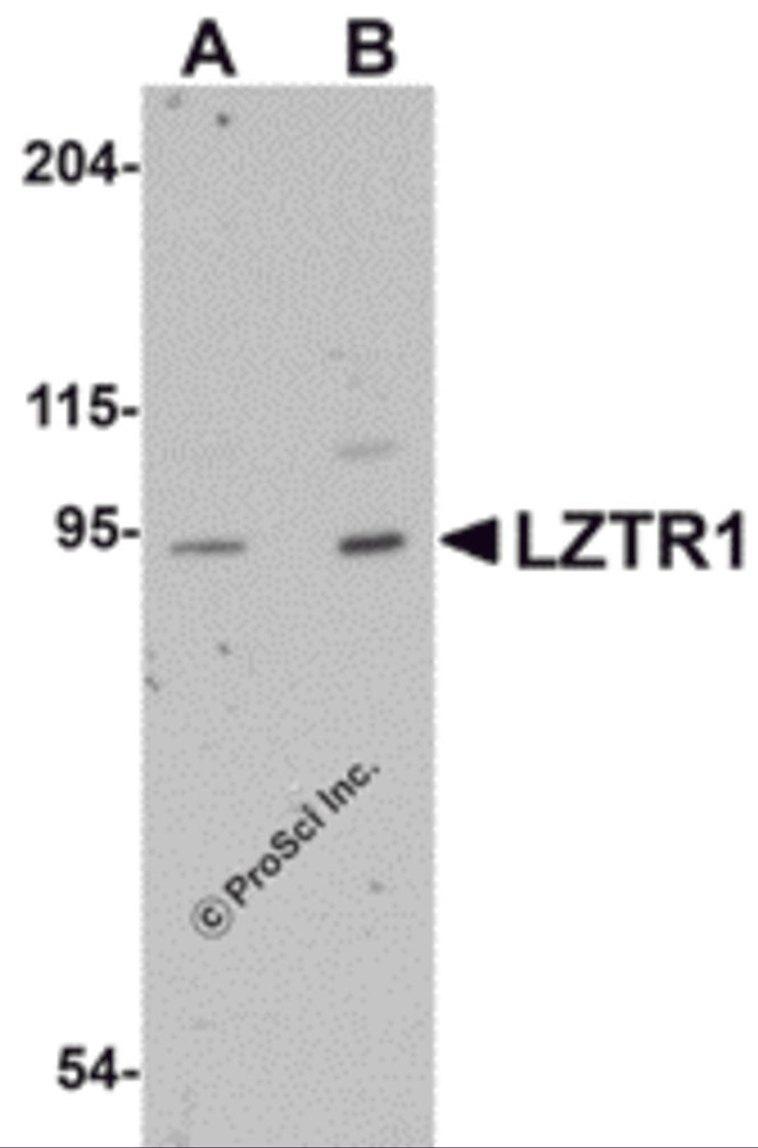 Western blot analysis of LZTR1 in human heart tissue lysate with LZTR1 antibody at (A) 1 and (B) 2 μg/mL.