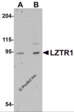 Western blot analysis of LZTR1 in human heart tissue lysate with LZTR1 antibody at (A) 1 and (B) 2 μg/mL.
