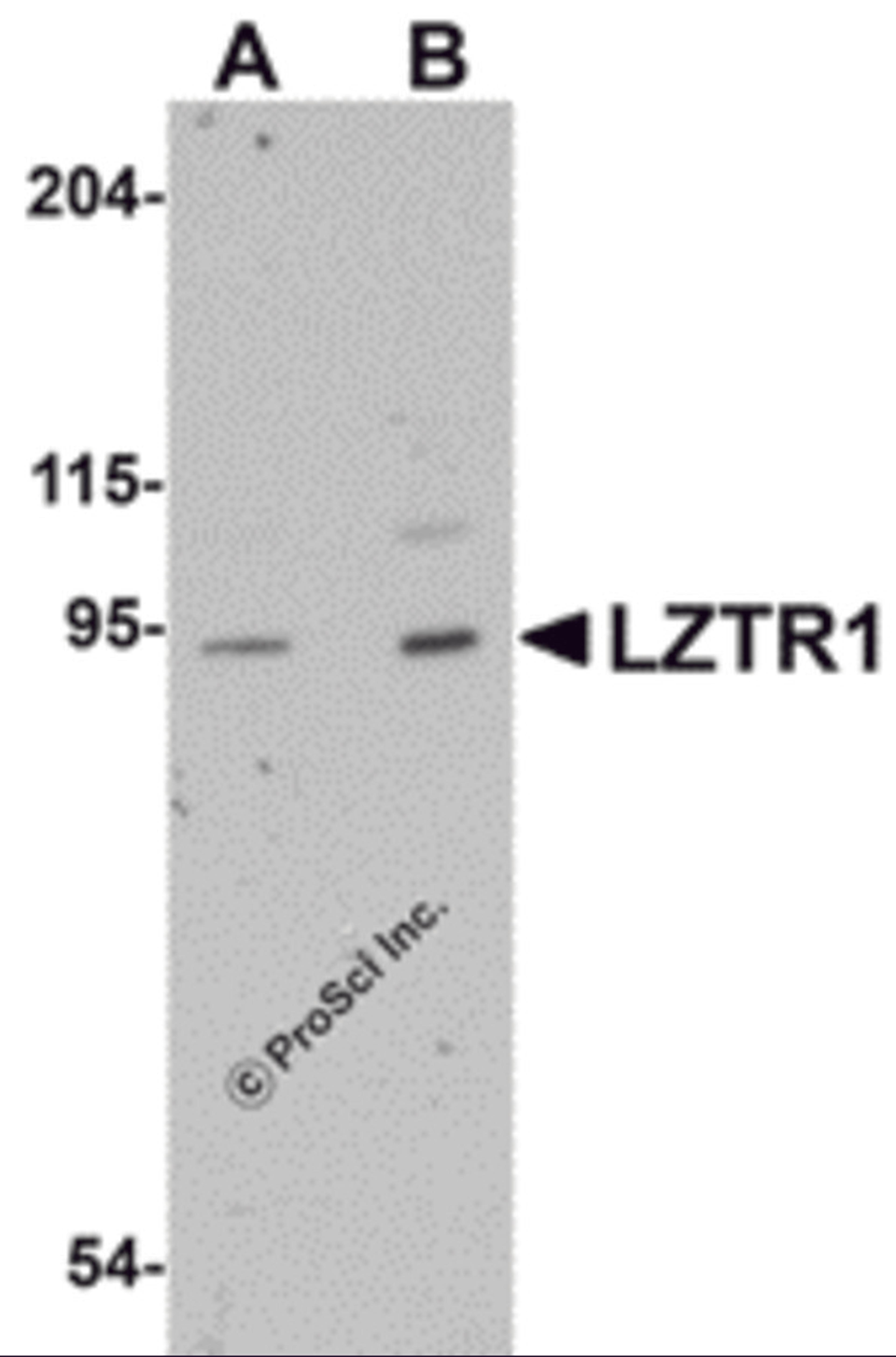 Western blot analysis of LZTR1 in human heart tissue lysate with LZTR1 antibody at (A) 1 and (B) 2 μg/mL.