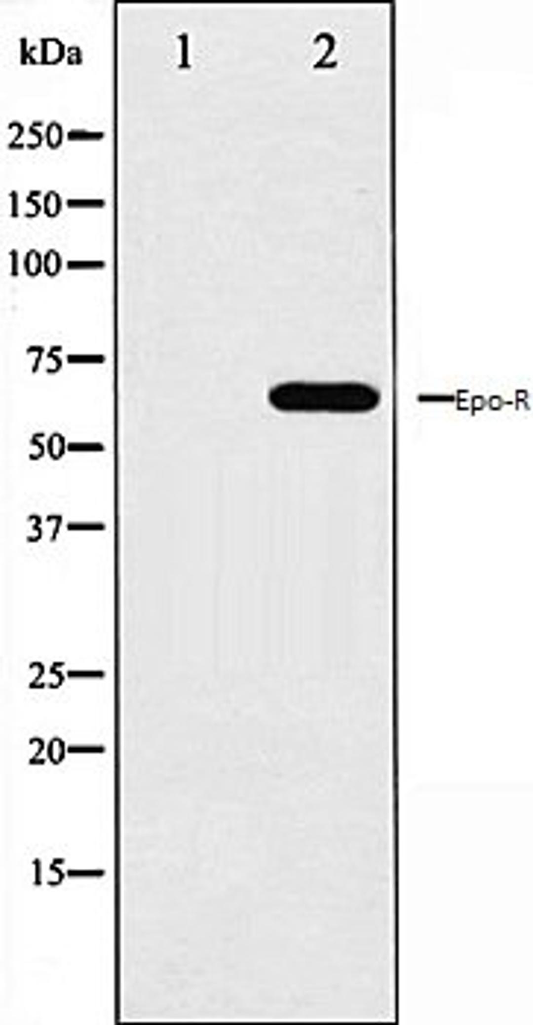 Western blot analysis of COS7 whole cell lysates using Epo-R antibody, The lane on the left is treated with the antigen-specific peptide.