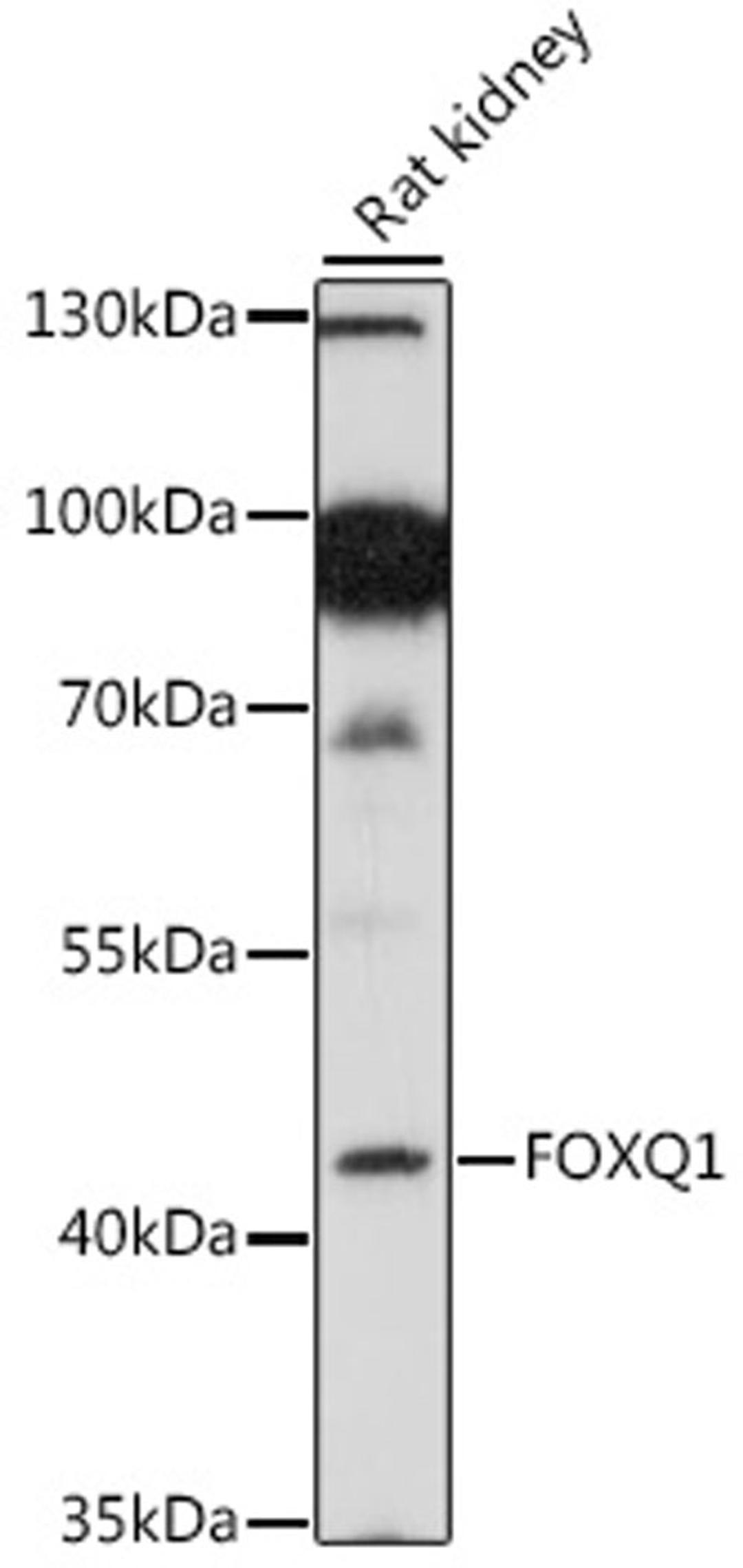 Western blot - FOXQ1 antibody (A16282)