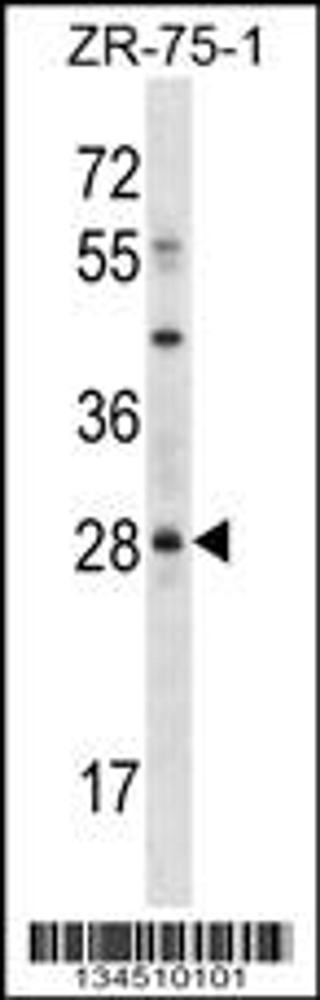 Western blot analysis in ZR-75-1 cell line lysates (35ug/lane).