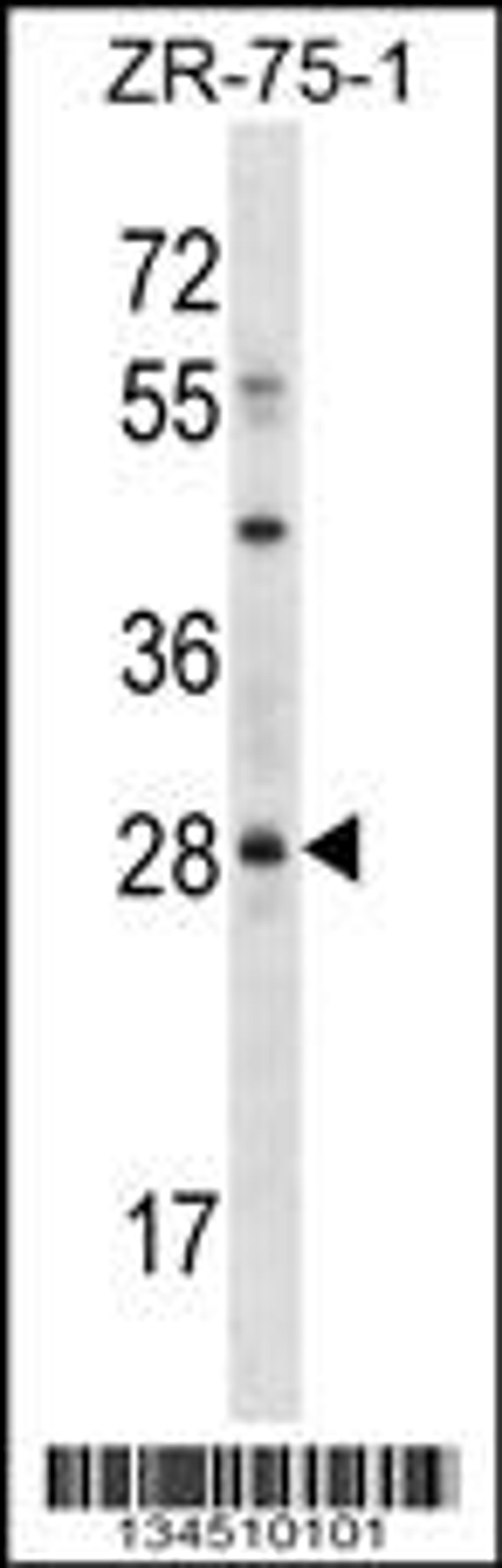 Western blot analysis in ZR-75-1 cell line lysates (35ug/lane).