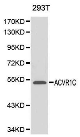 Western blot analysis of 293T cell lysate using ACVR1C antibody