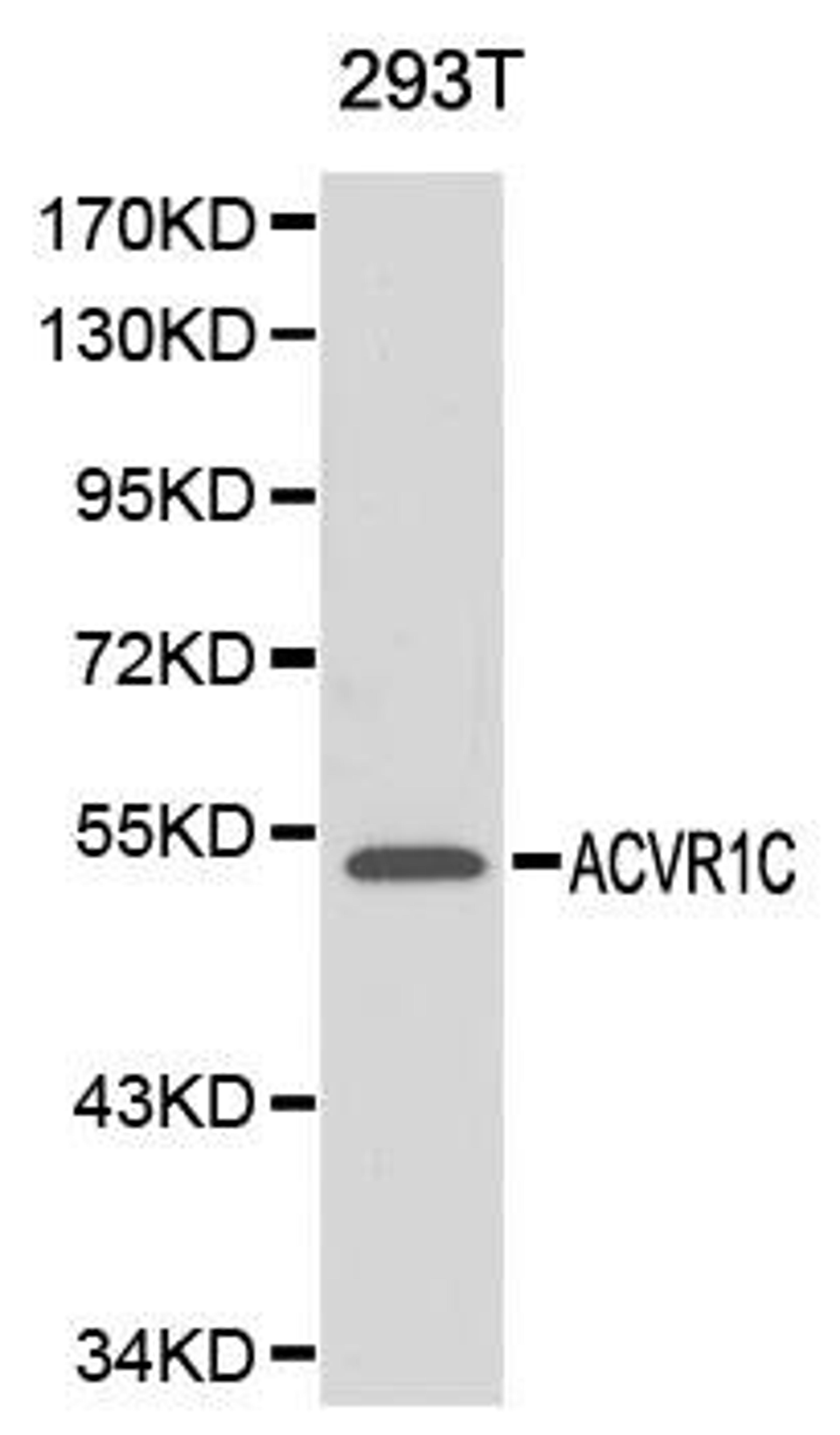 Western blot analysis of 293T cell lysate using ACVR1C antibody