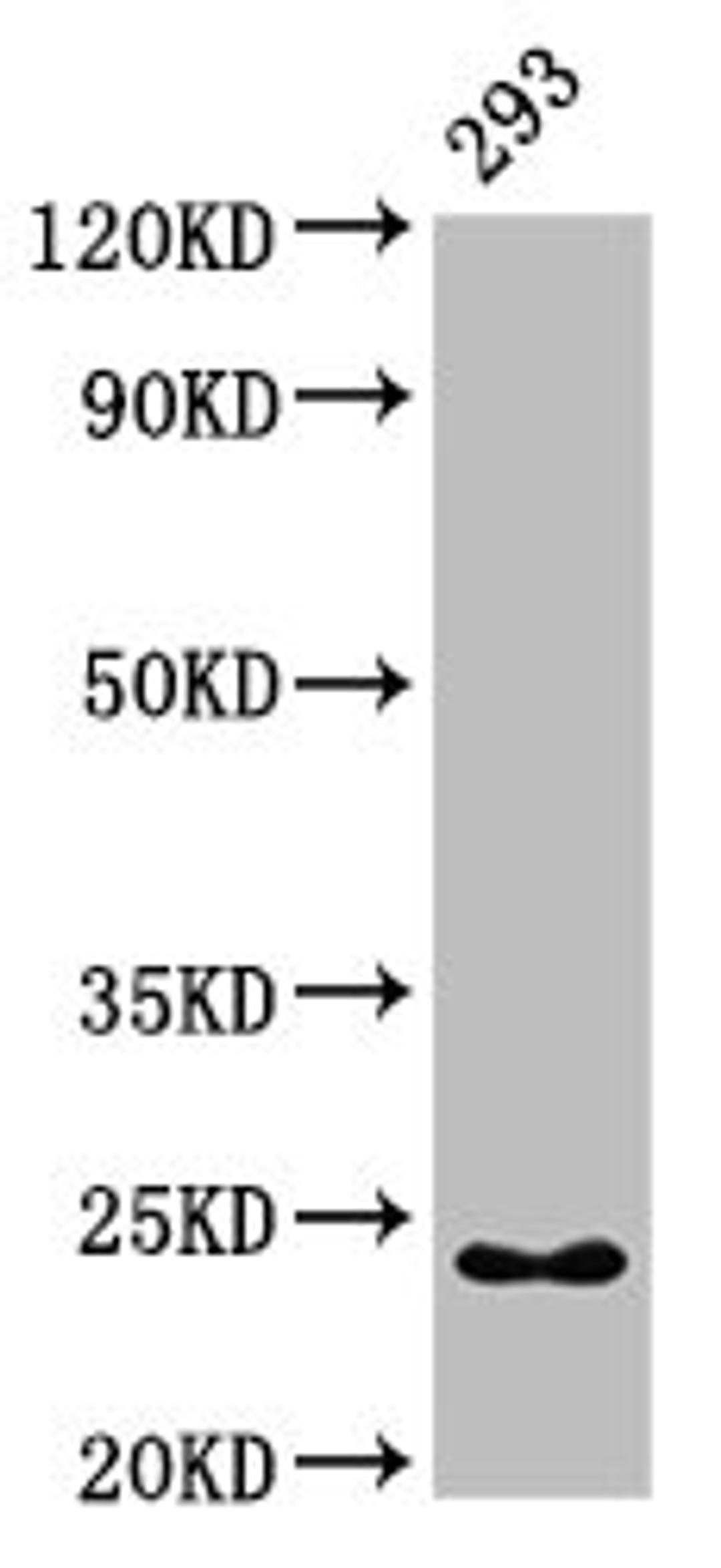 Western Blot. Positive WB detected in: 293 whole cell lysate. All lanes: HMGB3 antibody at 7µg/ml. Secondary. Goat polyclonal to rabbit IgG at 1/50000 dilution. Predicted band size: 23 kDa. Observed band size: 23 kDa
