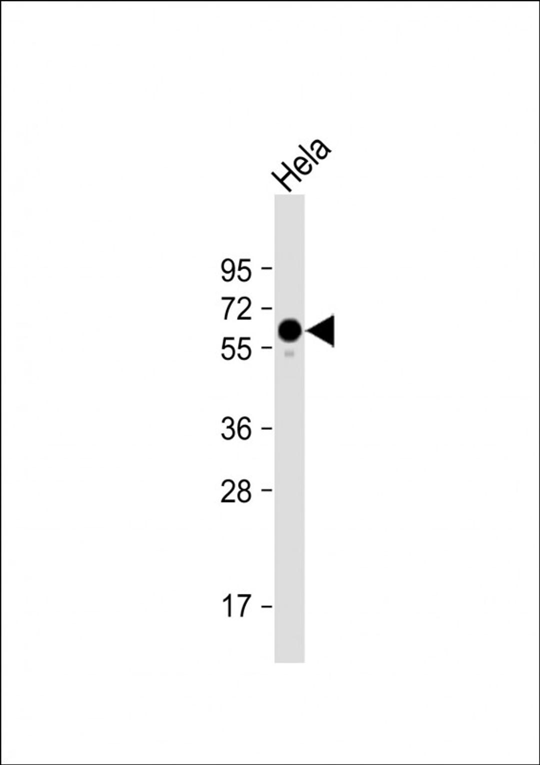 Western Blot at 1:1000 dilution + Hela whole cell lysate Lysates/proteins at 20 ug per lane.