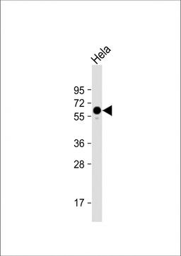 Western Blot at 1:1000 dilution + Hela whole cell lysate Lysates/proteins at 20 ug per lane.