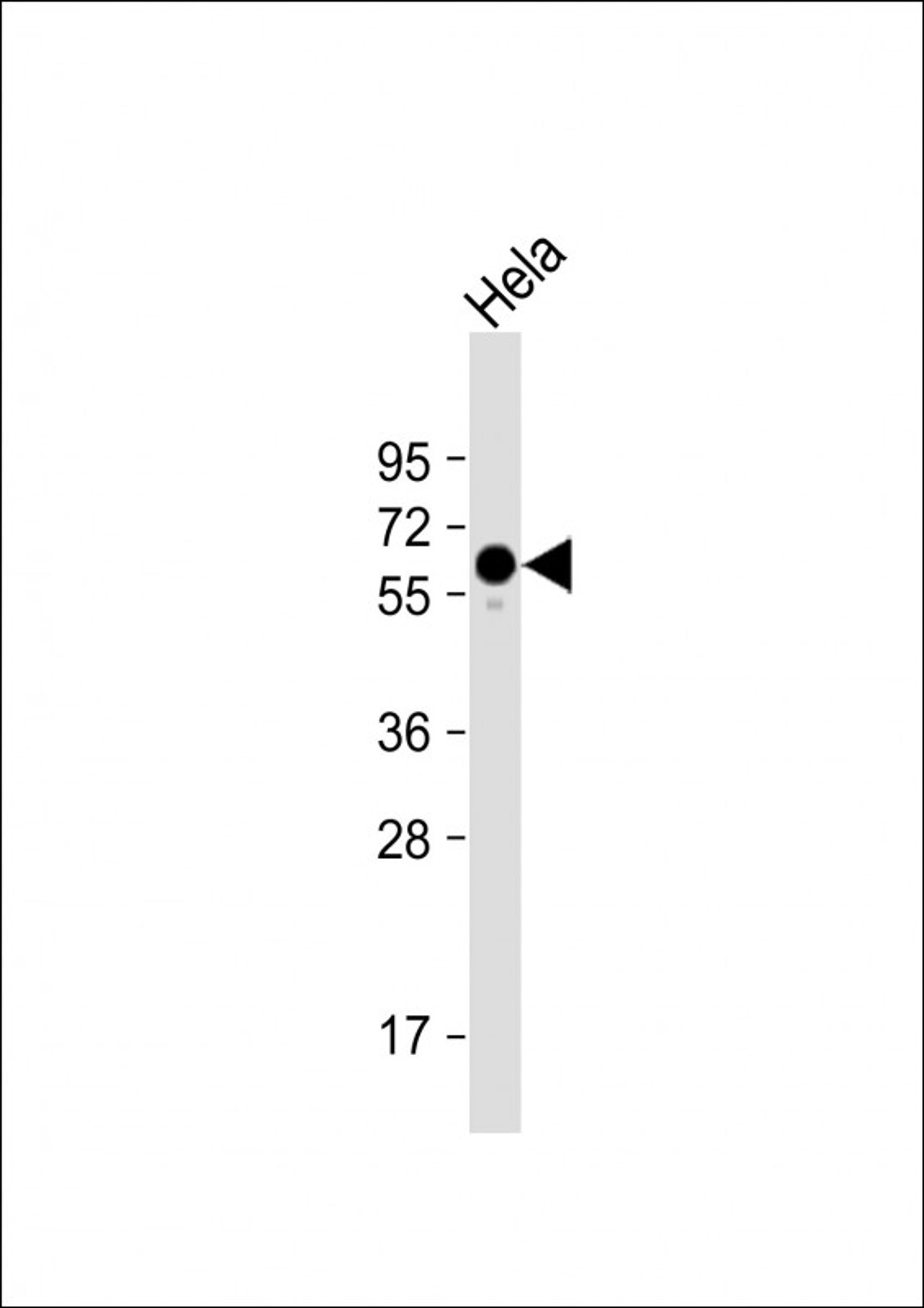 Western Blot at 1:1000 dilution + Hela whole cell lysate Lysates/proteins at 20 ug per lane.