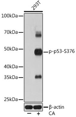 Western blot - Phospho-p53-S376 Rabbit mAb (AP0987)