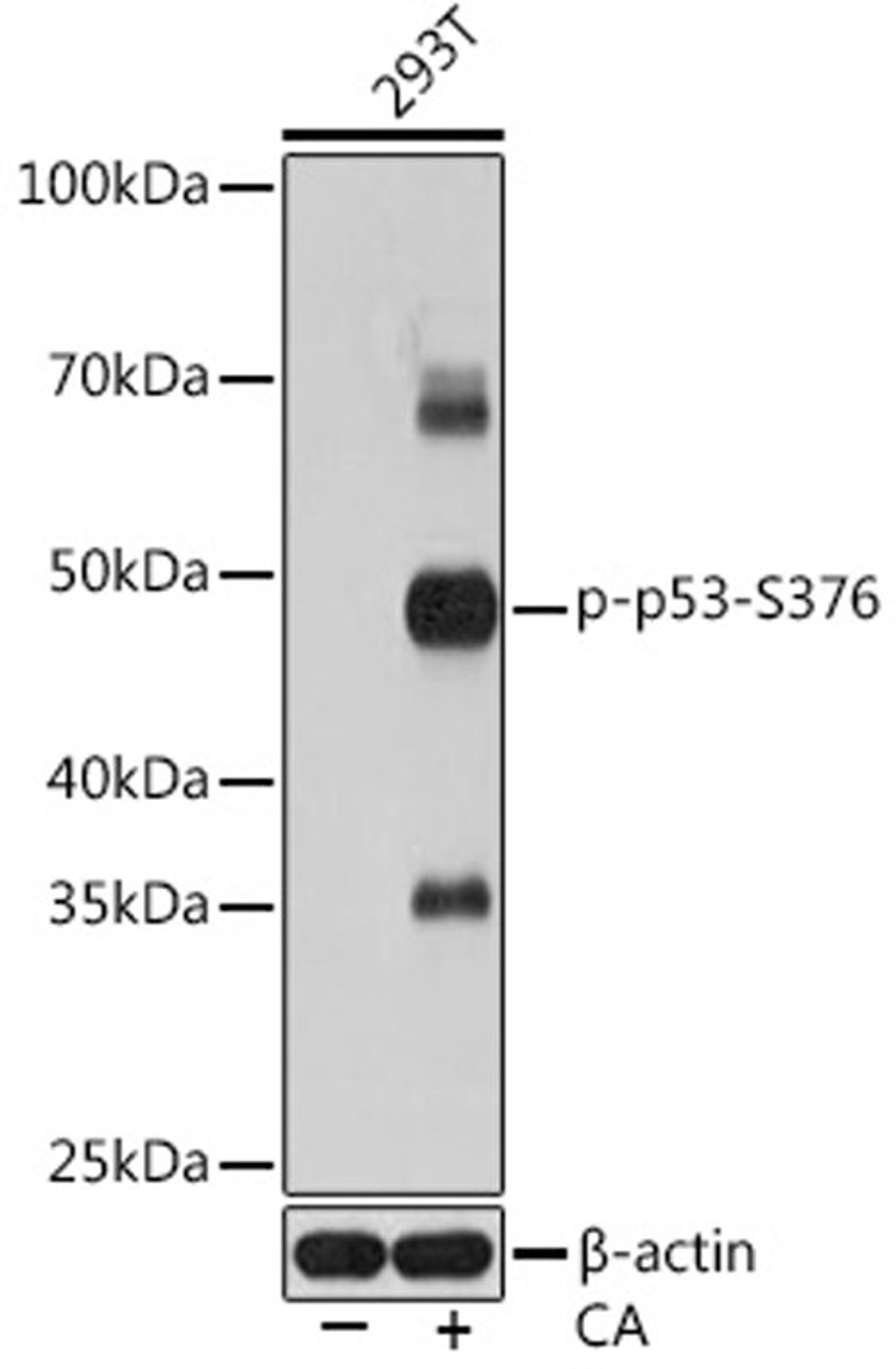 Western blot - Phospho-p53-S376 Rabbit mAb (AP0987)