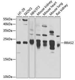 Western blot - RRAS2 antibody (A7076)