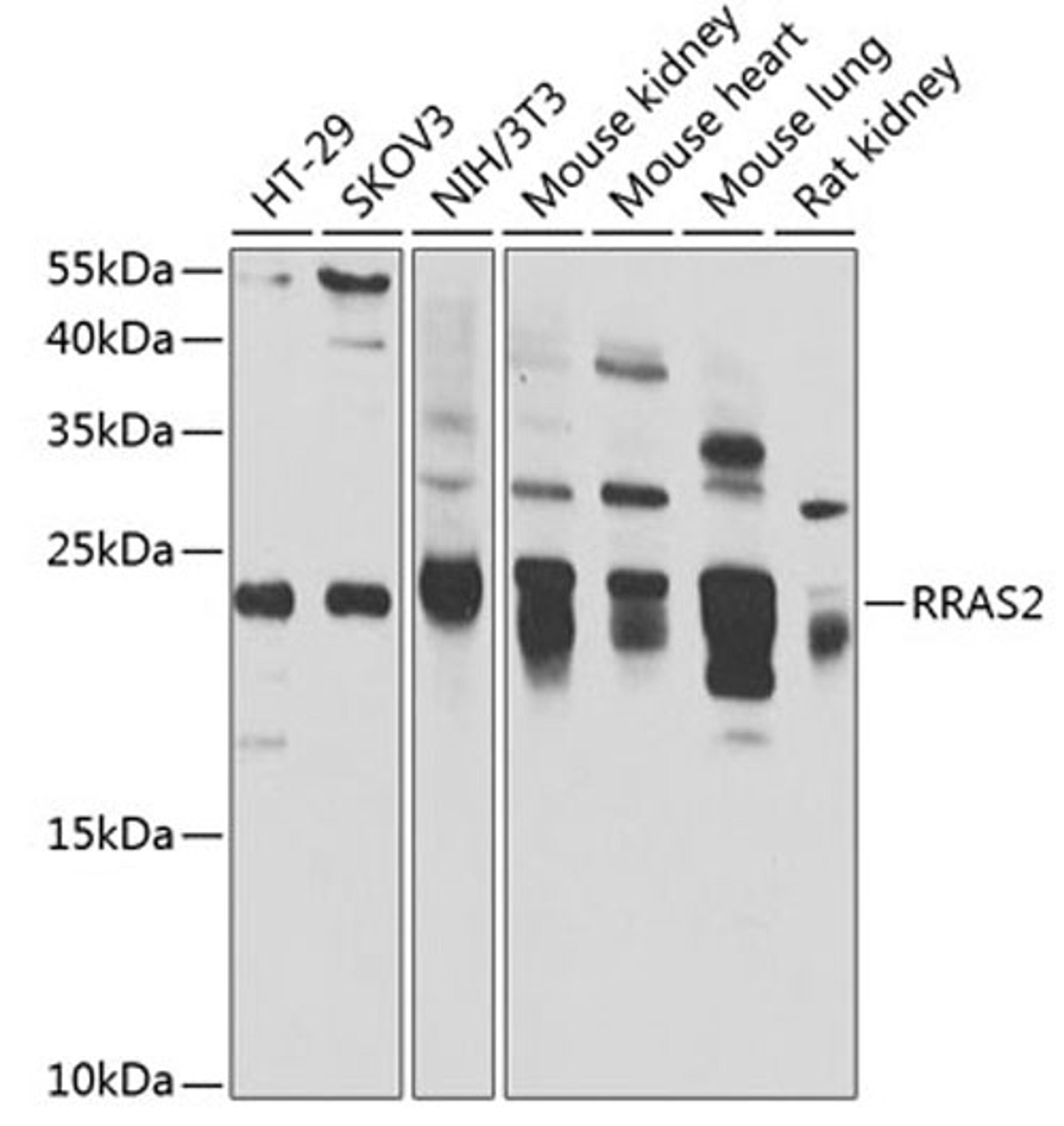 Western blot - RRAS2 antibody (A7076)