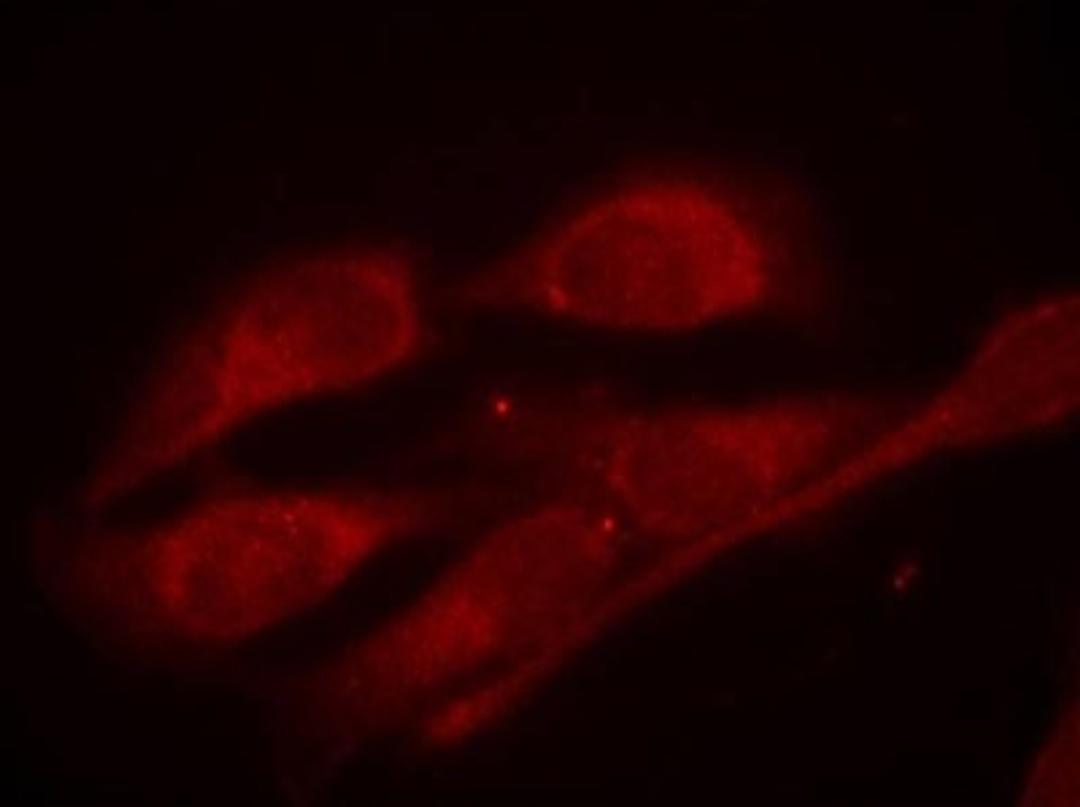 Immunocytochemistry/Immunofluorescence: SHC1 [p Tyr427] Antibody [NB100-82190] - Staining of methanol-fixed Hela cells using Shc1(Phospho-Tyr427) antibody