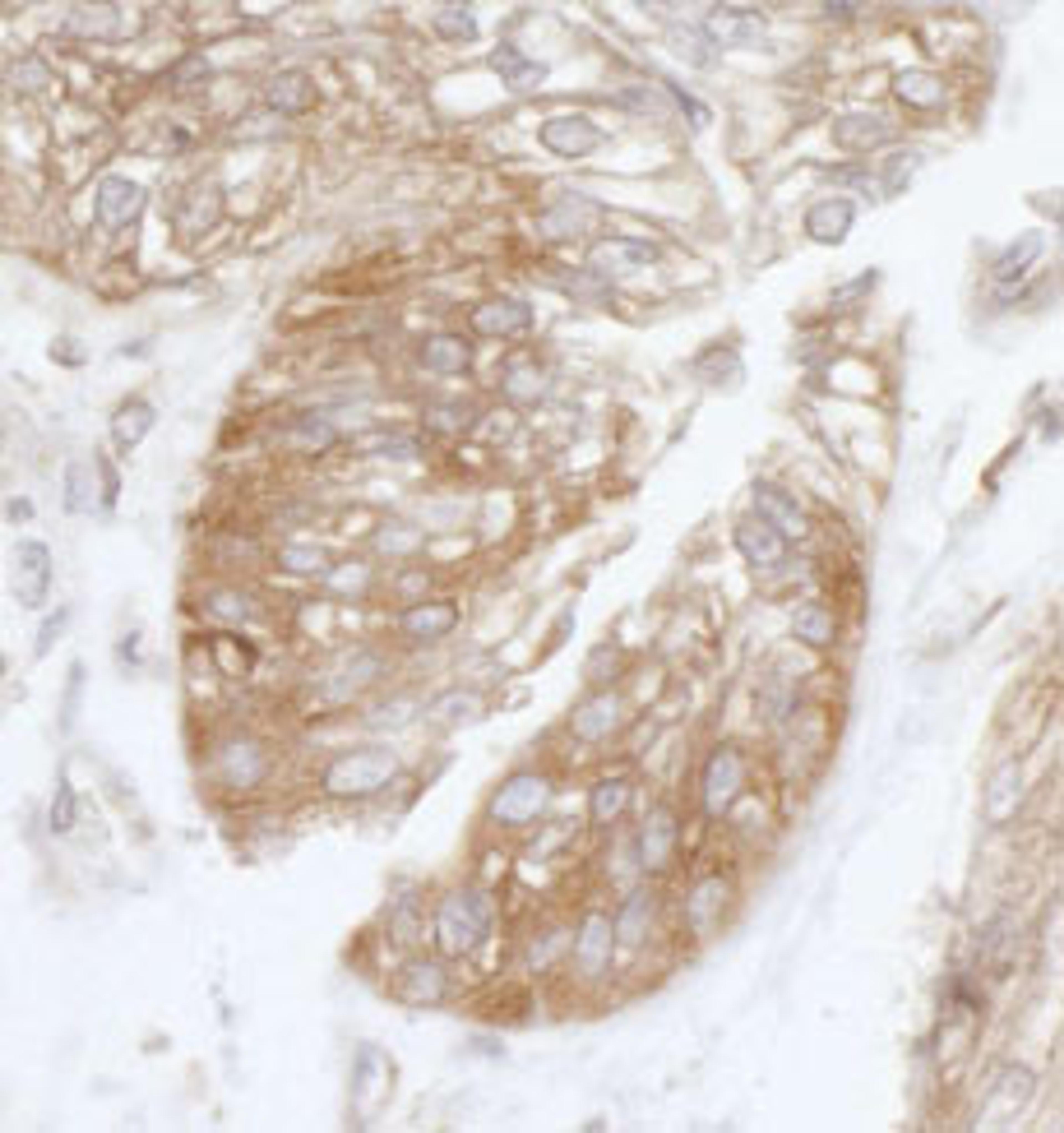 Detection of human EIF3S9/eIF3B by immunohistochemistry.