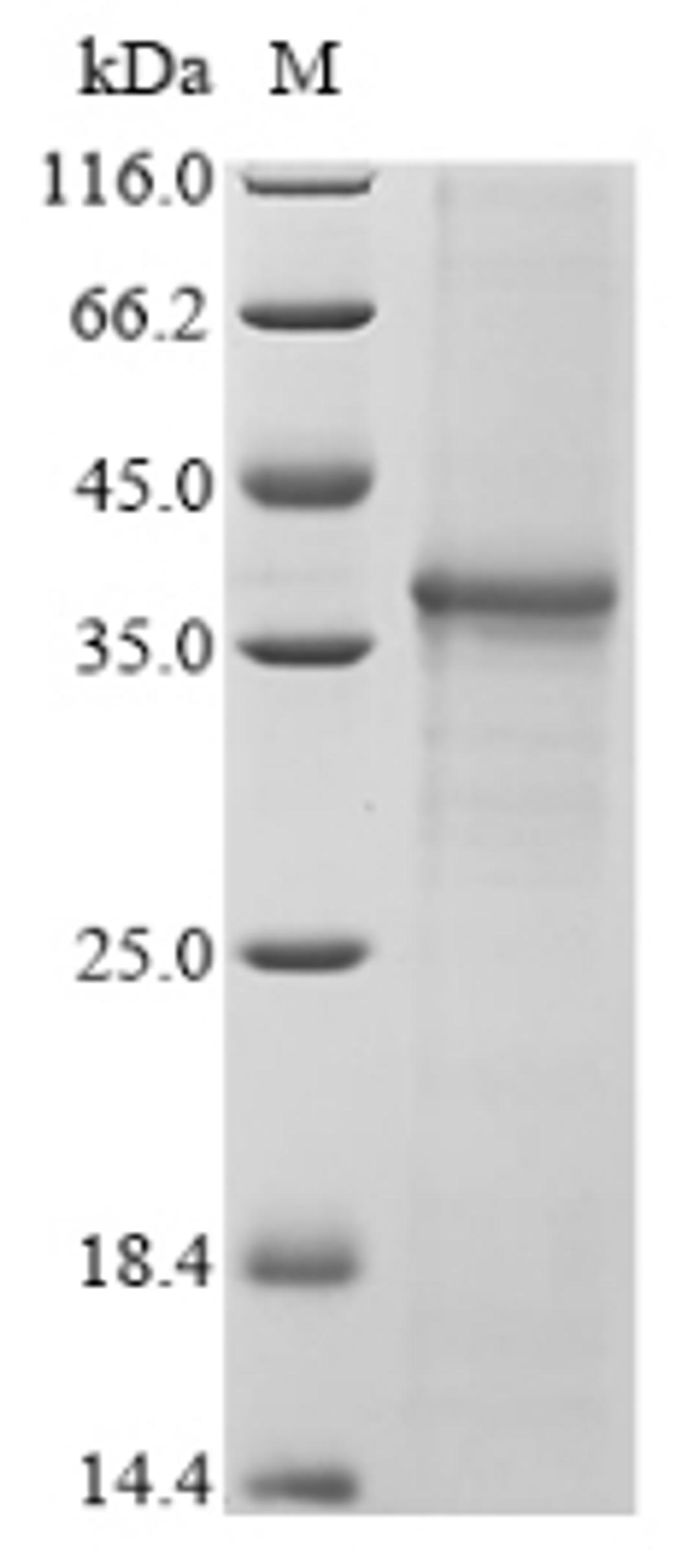(Tris-Glycine gel) Discontinuous SDS-PAGE (reduced) with 5% enrichment gel and 15% separation gel.