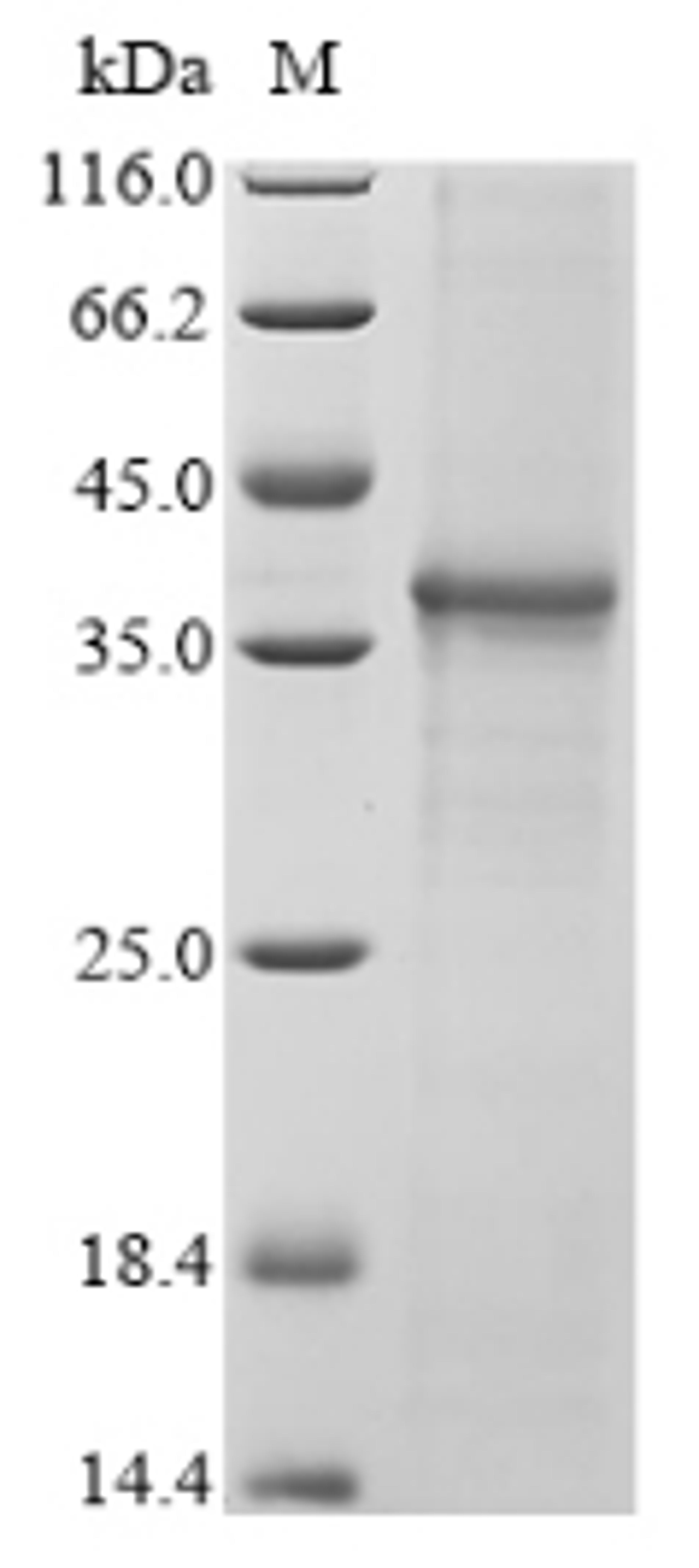 (Tris-Glycine gel) Discontinuous SDS-PAGE (reduced) with 5% enrichment gel and 15% separation gel.