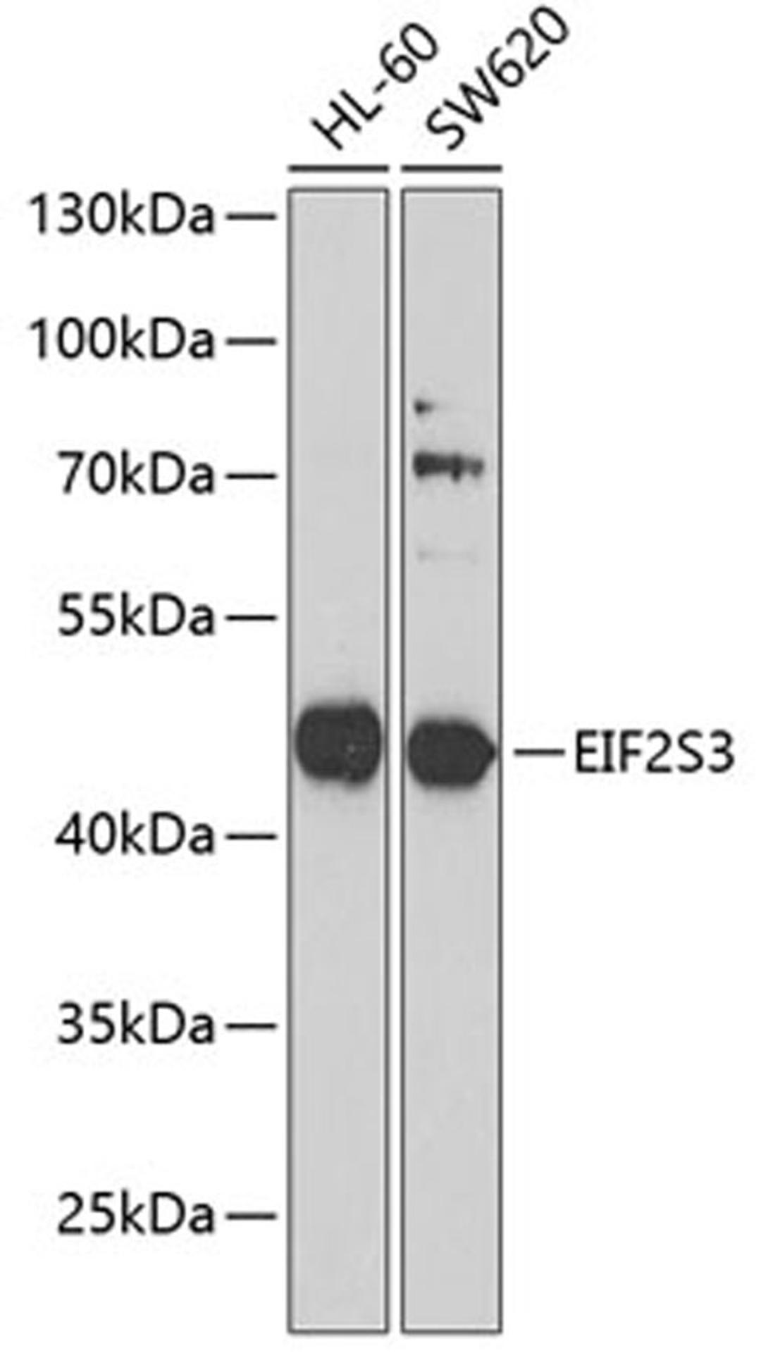 Western blot - EIF2S3 antibody (A6581)