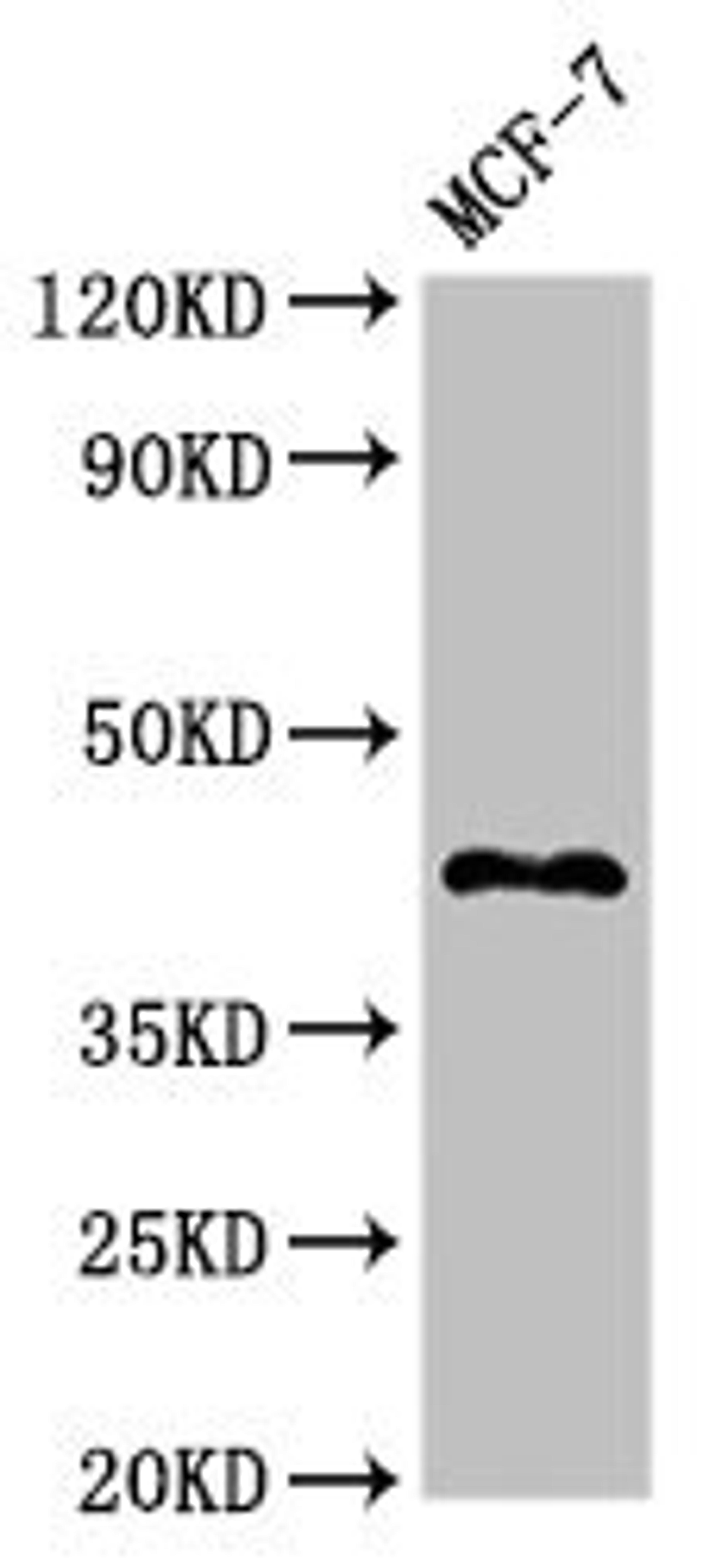 Western Blot. Positive WB detected in: MCF-7 whole cell lysate. All lanes: TMEM173 antibody at 2.7µg/ml. Secondary. Goat polyclonal to rabbit IgG at 1/50000 dilution. Predicted band size: 43 kDa. Observed band size: 43 kDa