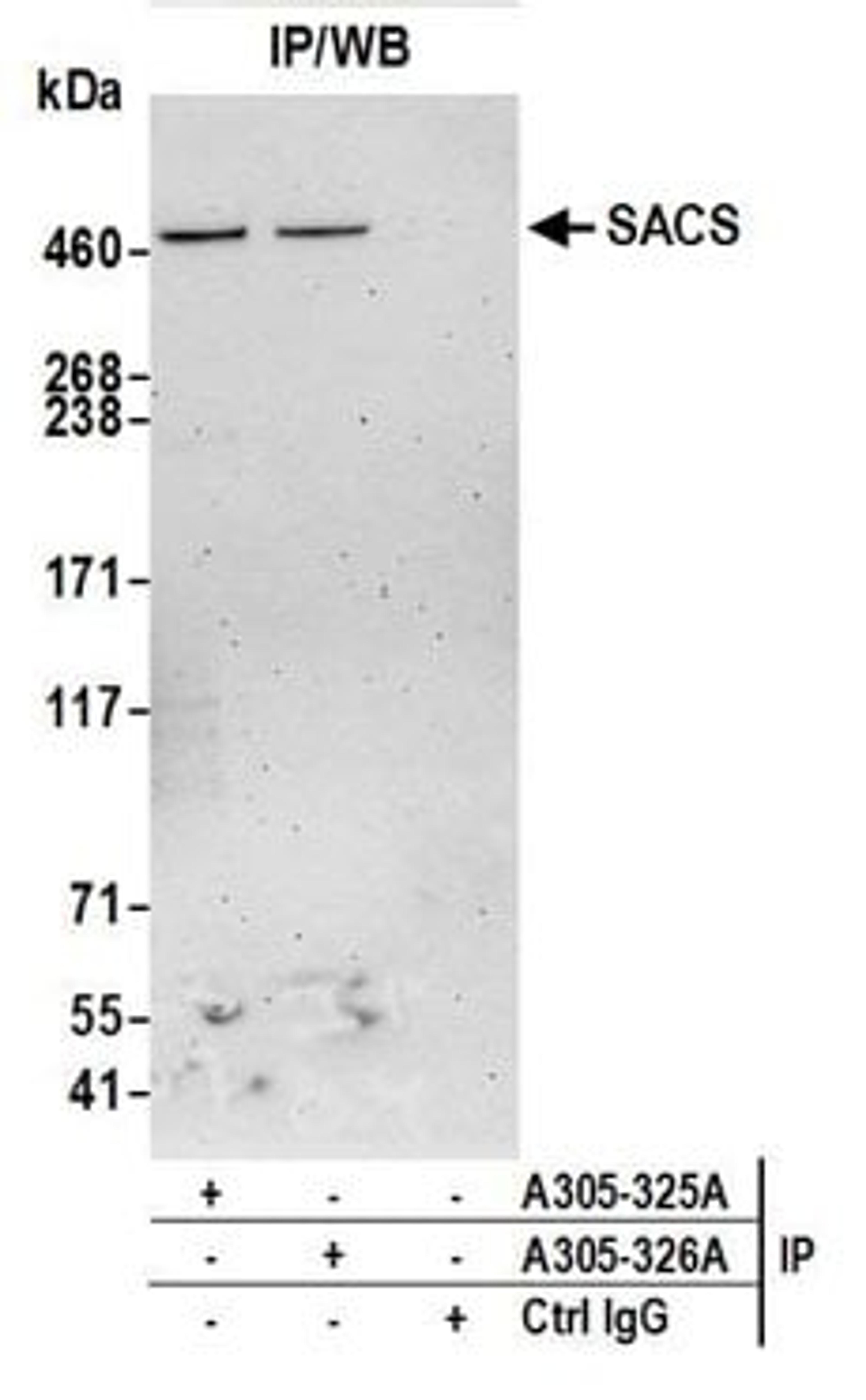 Detection of human SACS by western blot of immunoprecipitates.