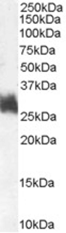 45-631 (1ug/ml) staining of Human Bone Marrow lysate (35ug protein in RIPA buffer). Primary incubation was 1 hour. Detected by chemiluminescence.