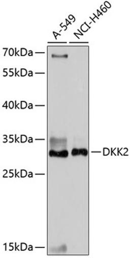 Western blot - DKK2 antibody (A14874)