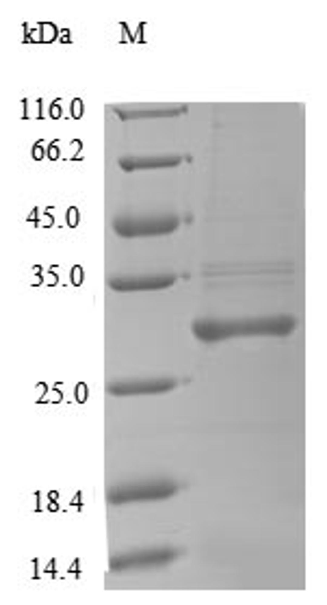 (Tris-Glycine gel) Discontinuous SDS-PAGE (reduced) with 5% enrichment gel and 15% separation gel.