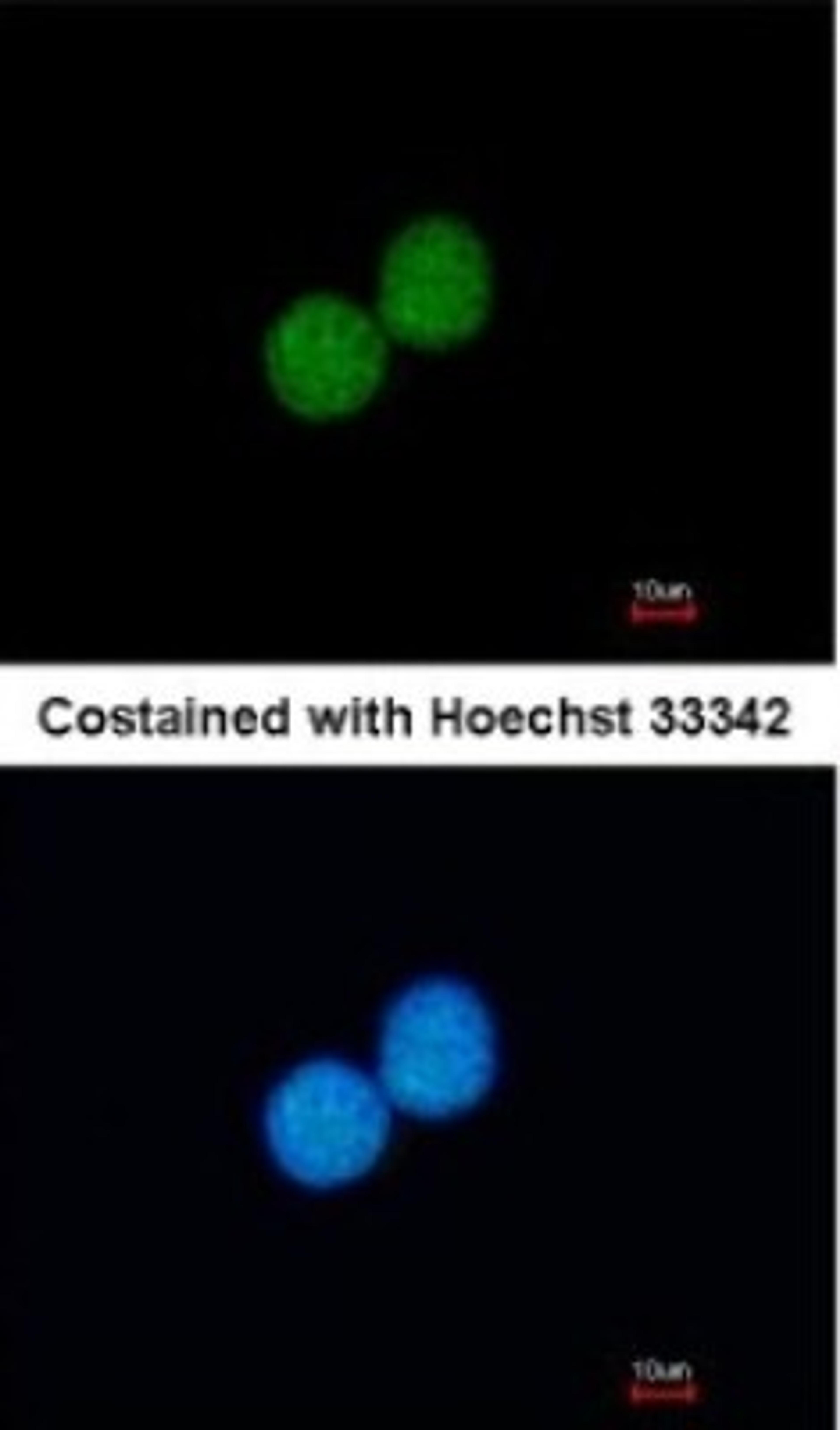 Immunocytochemistry/Immunofluorescence: NUP88 Antibody [NBP1-31796] - Paraformaldehyde-fixed A431, using antibody at 1:200 dilution.