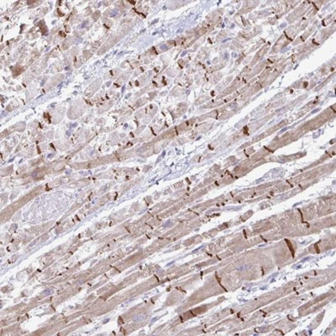 Immunohistochemistry: ZNF736 Antibody [NBP2-32587] - Staining of human heart muscle shows distinct membranous and cytoplasmic positivity in myocytes. (Intercalated disc distinctly stained).