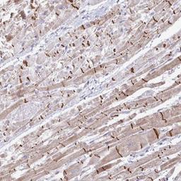 Immunohistochemistry: ZNF736 Antibody [NBP2-32587] - Staining of human heart muscle shows distinct membranous and cytoplasmic positivity in myocytes. (Intercalated disc distinctly stained).