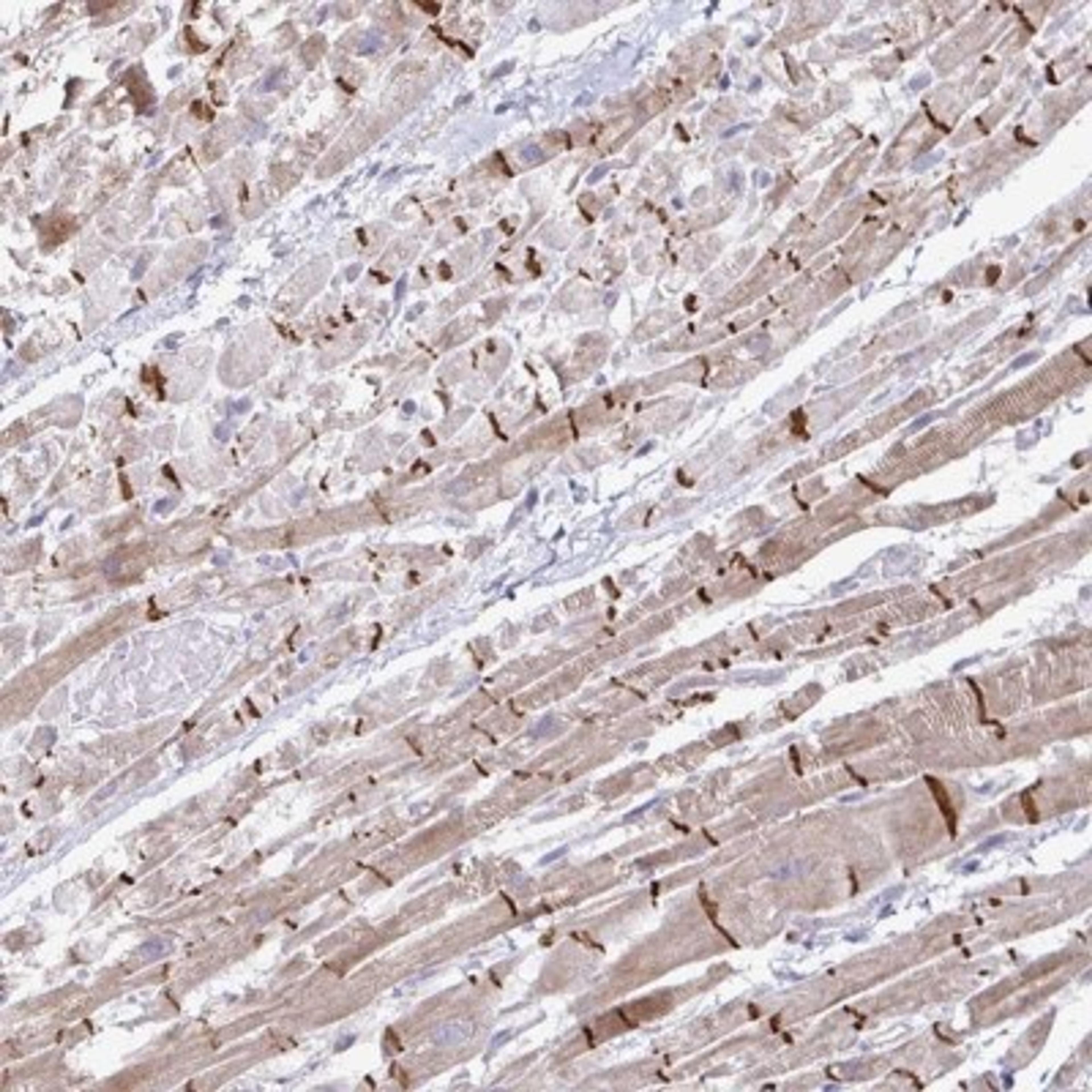 Immunohistochemistry: ZNF736 Antibody [NBP2-32587] - Staining of human heart muscle shows distinct membranous and cytoplasmic positivity in myocytes. (Intercalated disc distinctly stained).