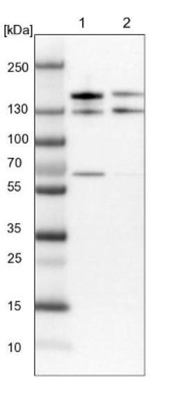 Western Blot: TSC2 Antibody [NBP1-82849] - Lane 1: Mouse liver tissue lysate<br/>Lane 2: Rat liver tissue lysate