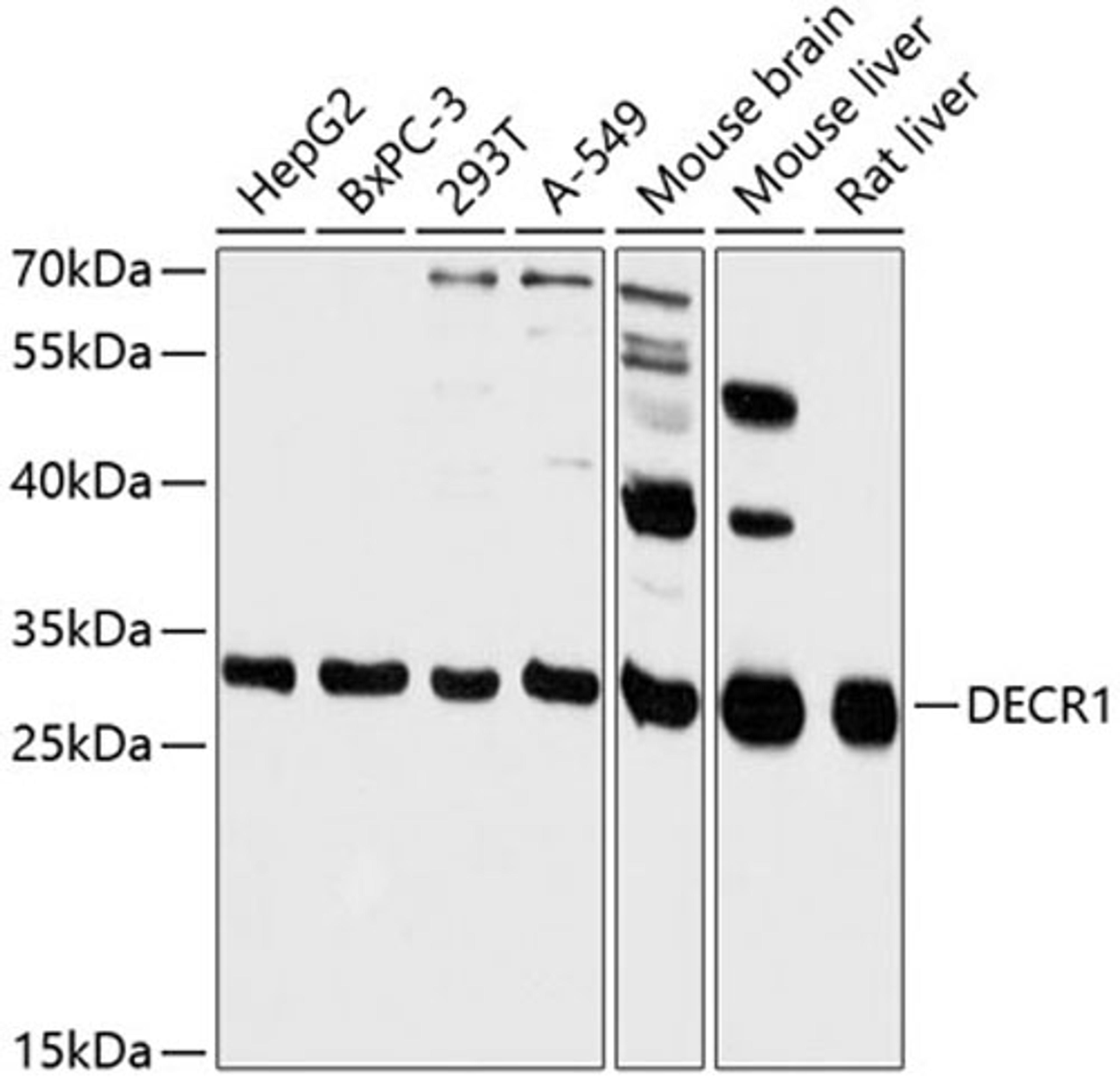 Western blot - DECR1 antibody (A13014)