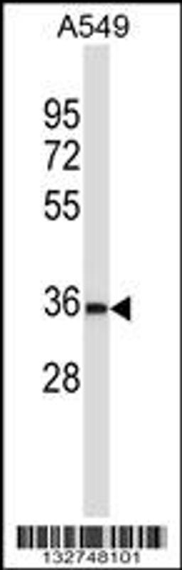 Western blot analysis in A549 cell line lysates (35ug/lane).